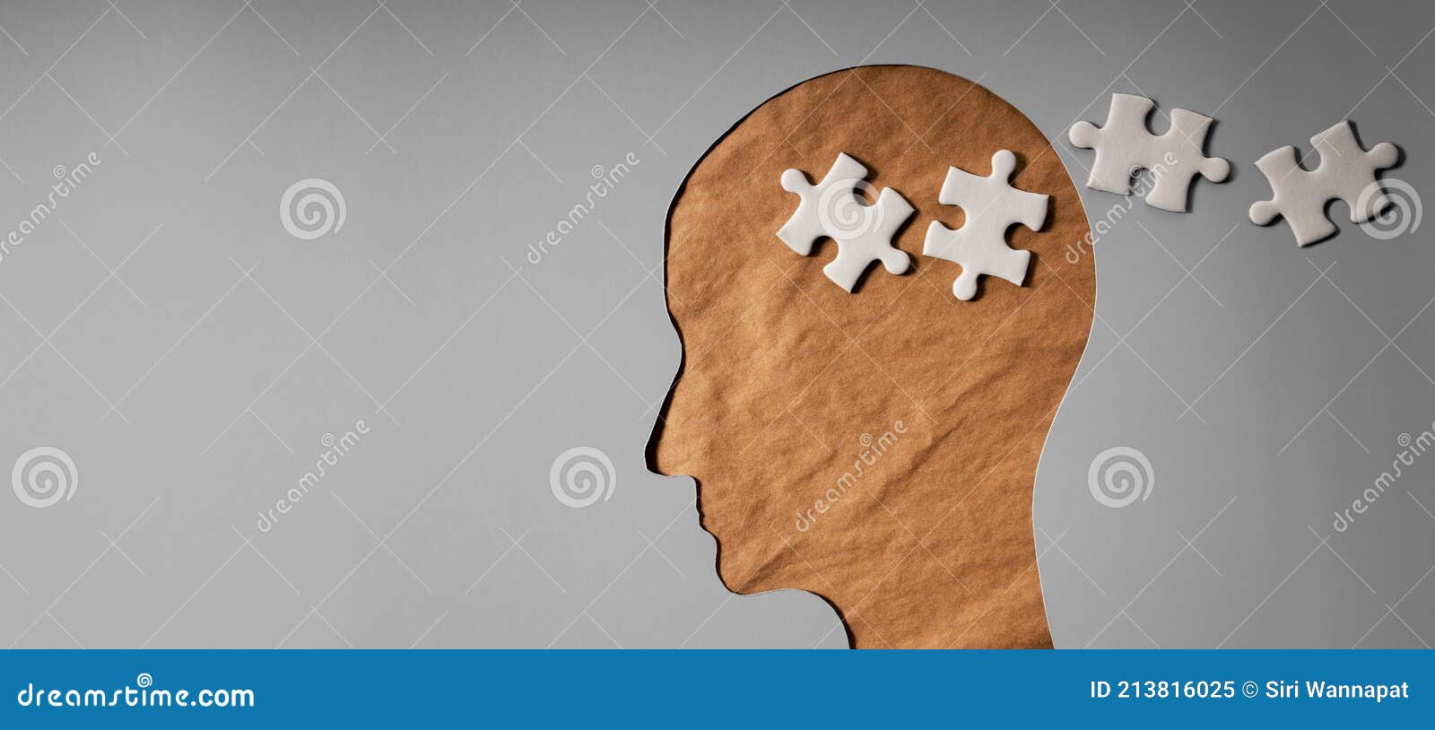 memory loss diseases memory loss diseases