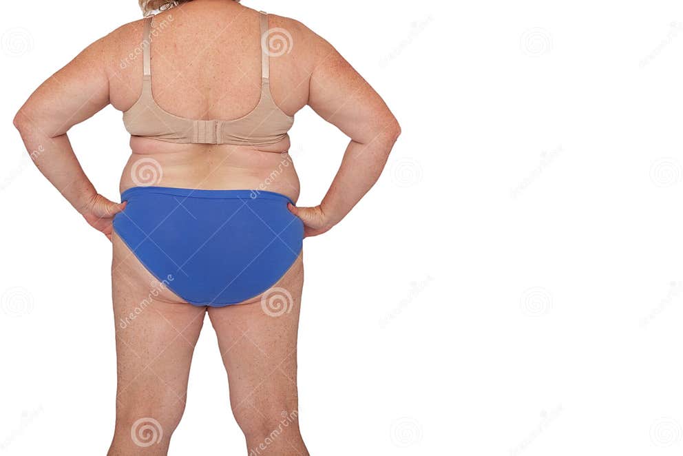 menopausal-woman-with-weight-gain-after-brachioplasty-panniculectomy