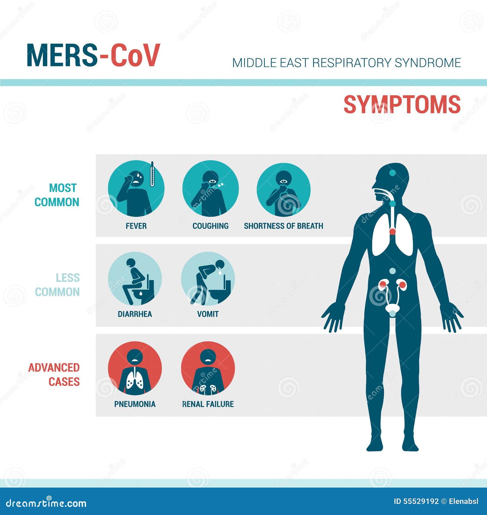 MERS CoV Symptoms Stock Vector - Image: 55529192