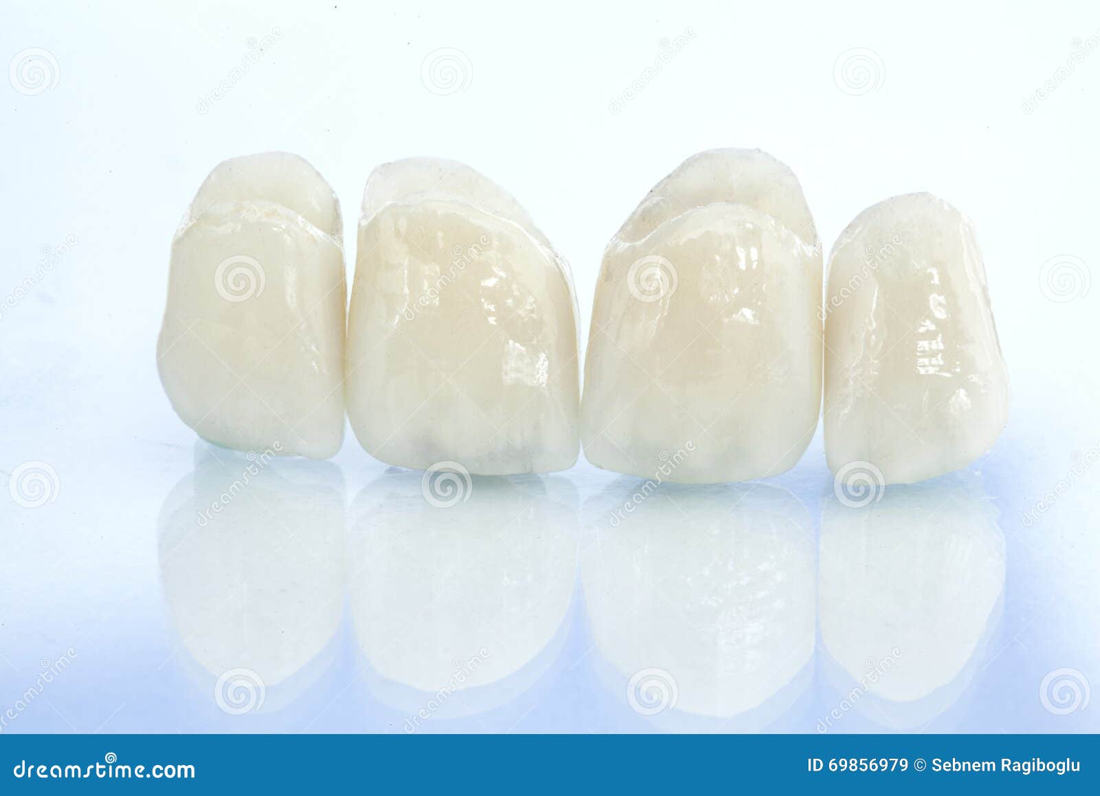 metal free ceramic dental crowns