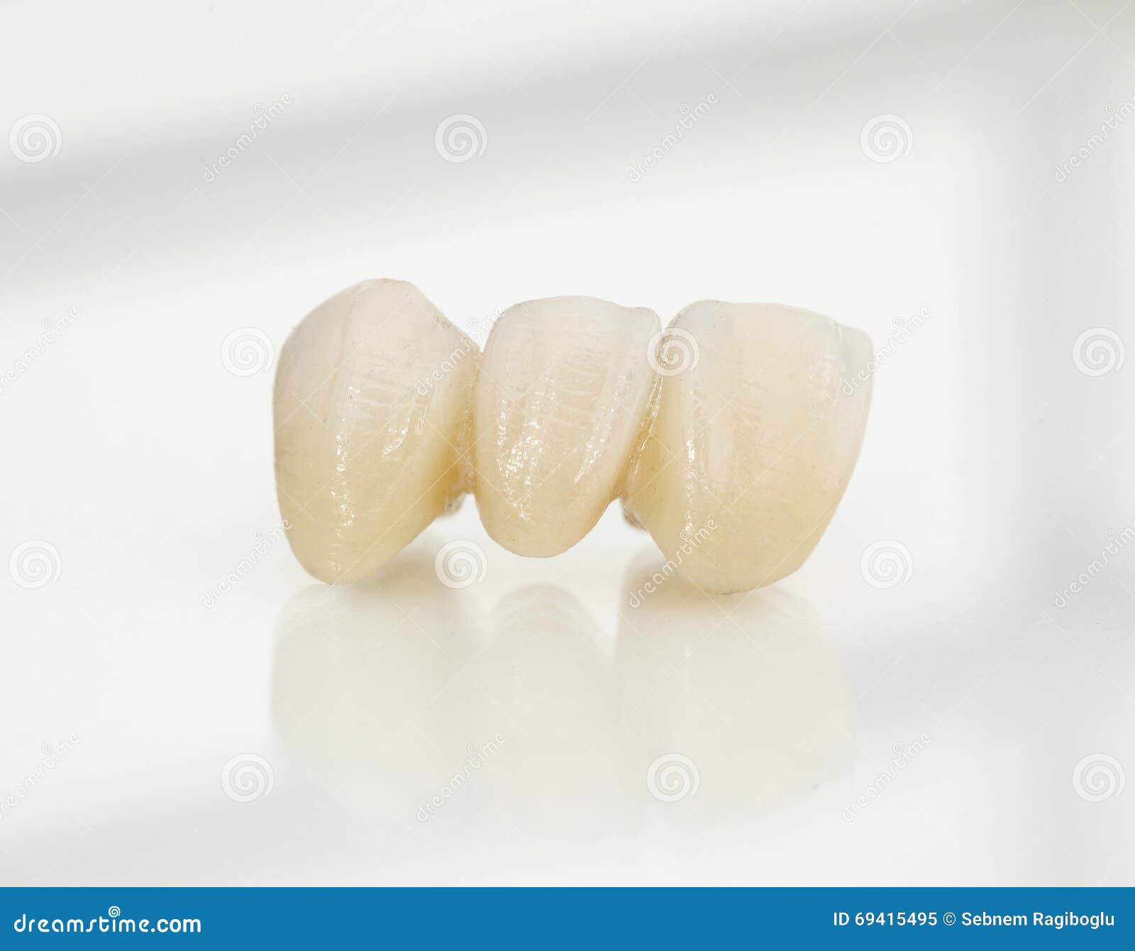 Set Of Dental Crowns Model Made Of Ceramic For Studying Morphology And