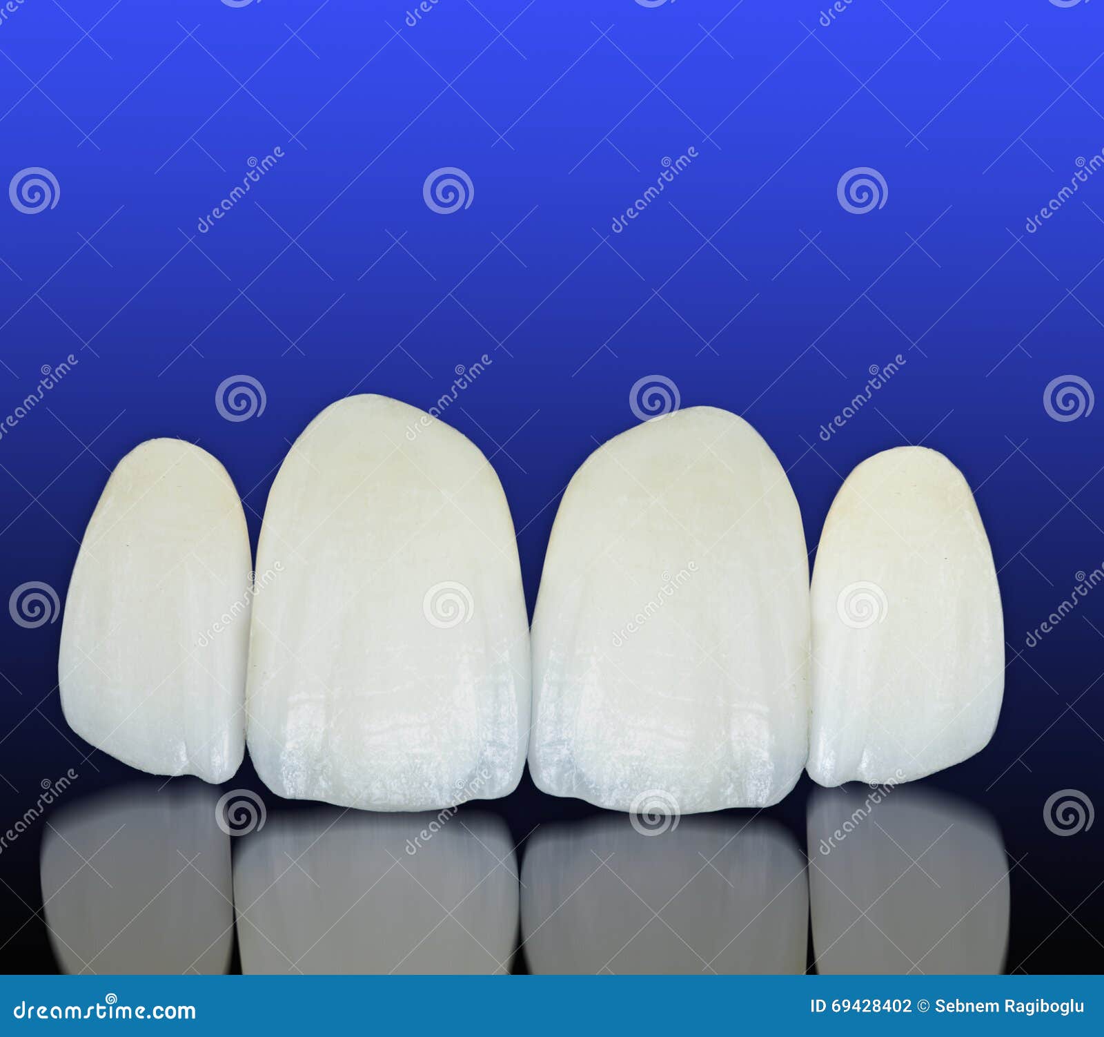 Metal Free Ceramic Dental Crowns Stock Photo Image of dental, care