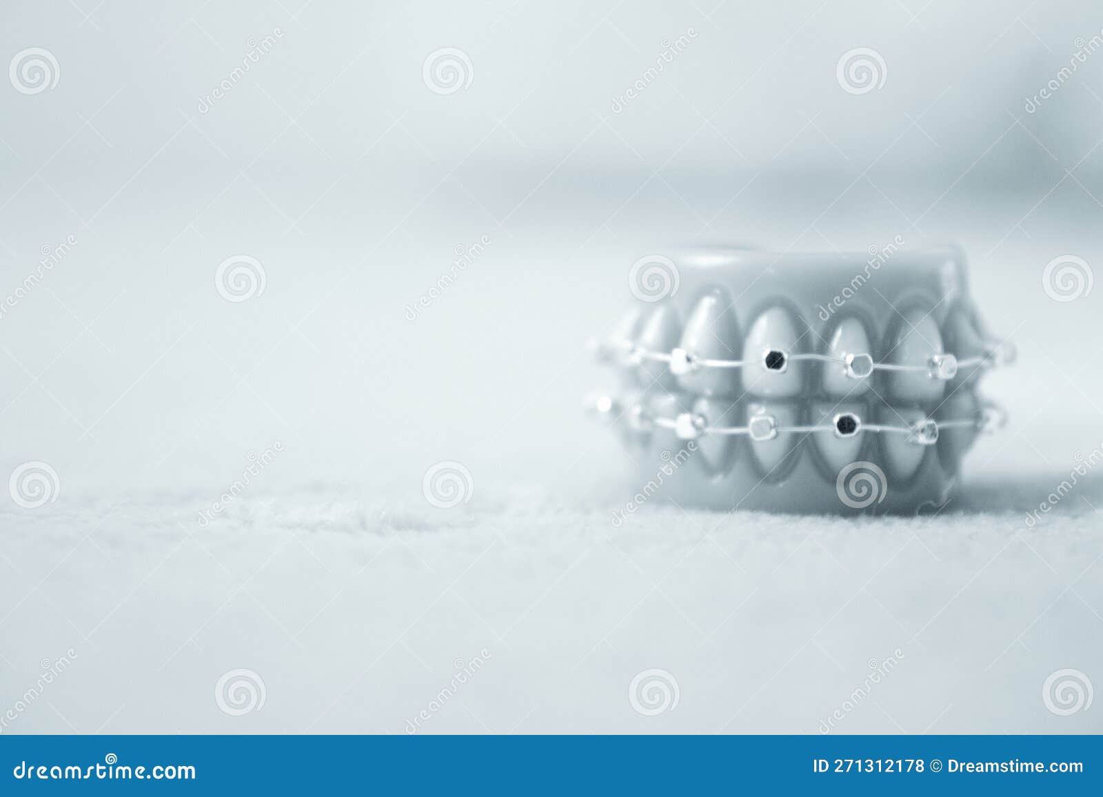 Metal Orthodontic Denture Base Stock Photo Image of medicine, care
