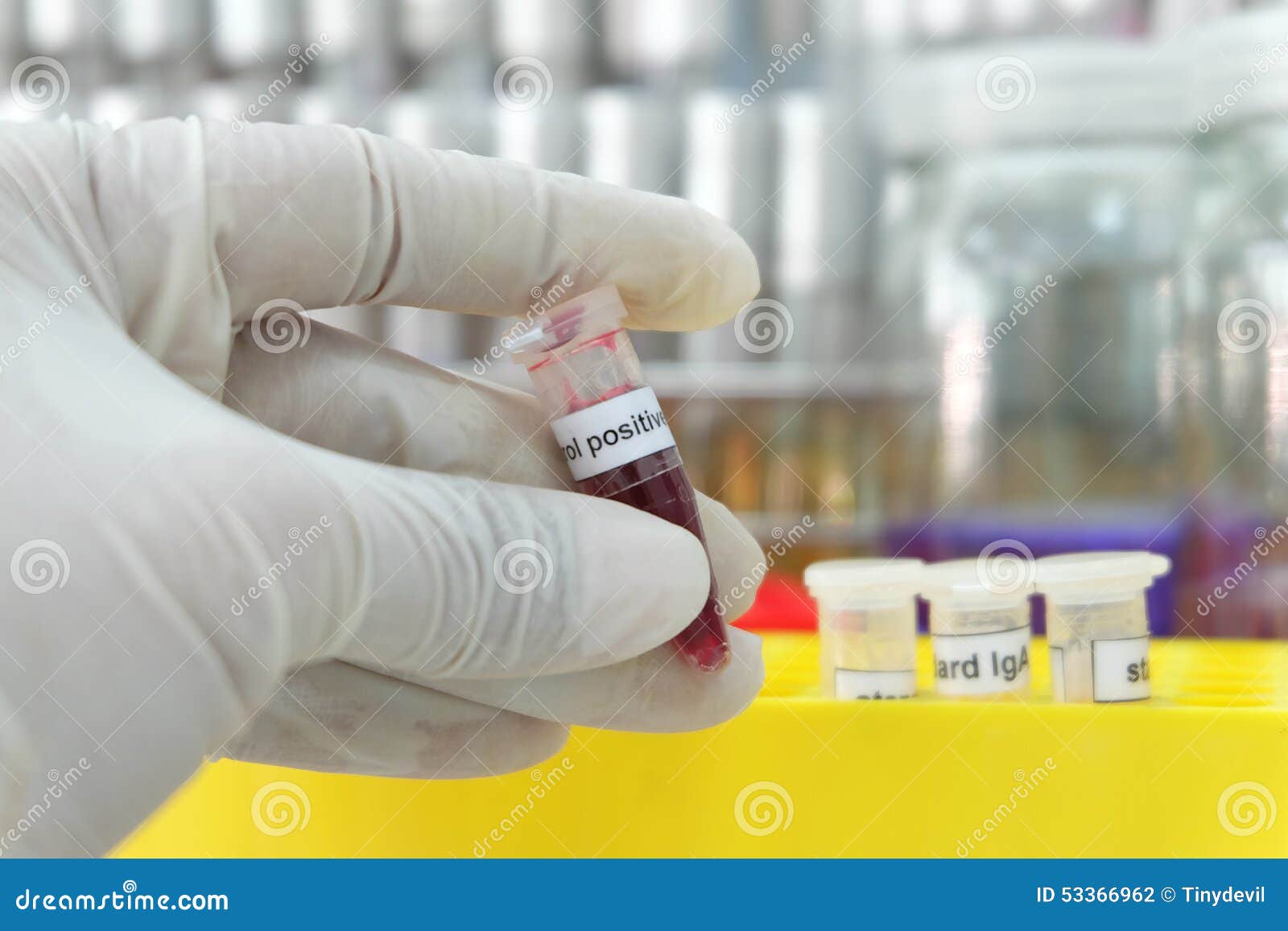 Microbiology Tool for Laboratory Test Stock Photo Image of care, drug