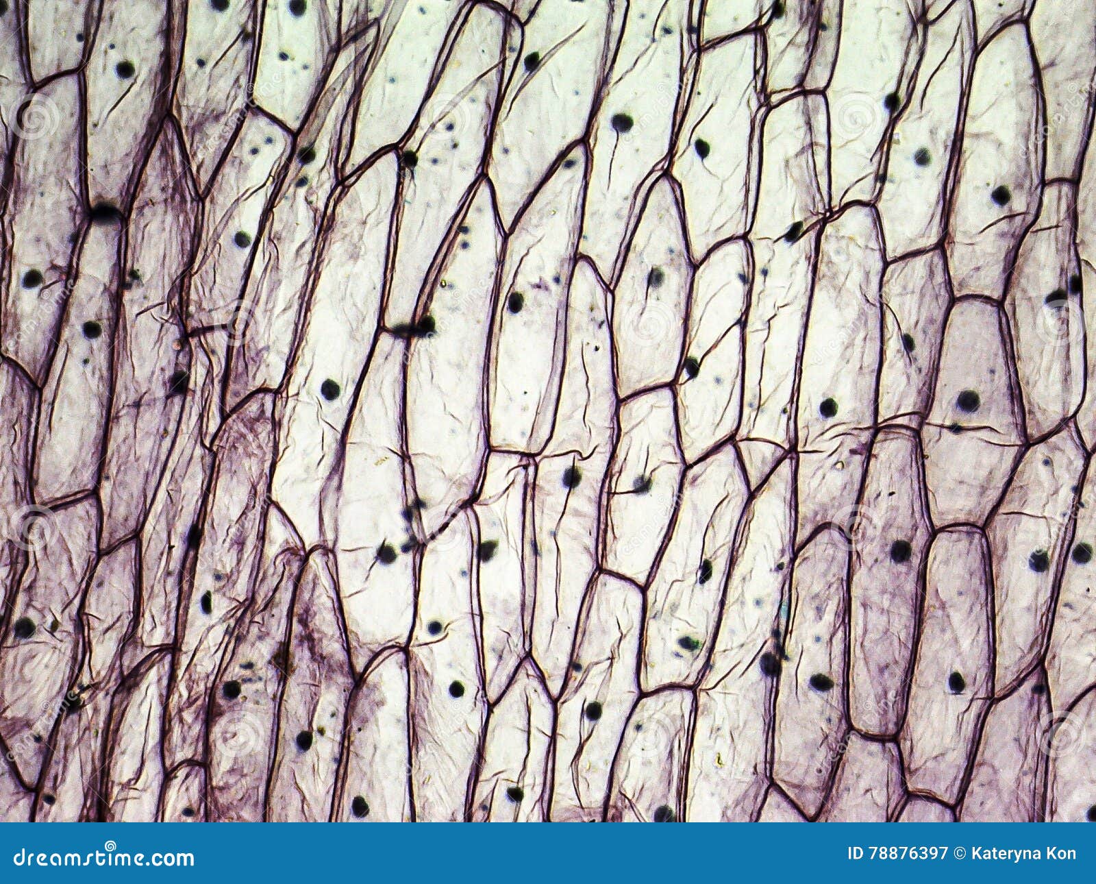 onion epidermal cells under microscope