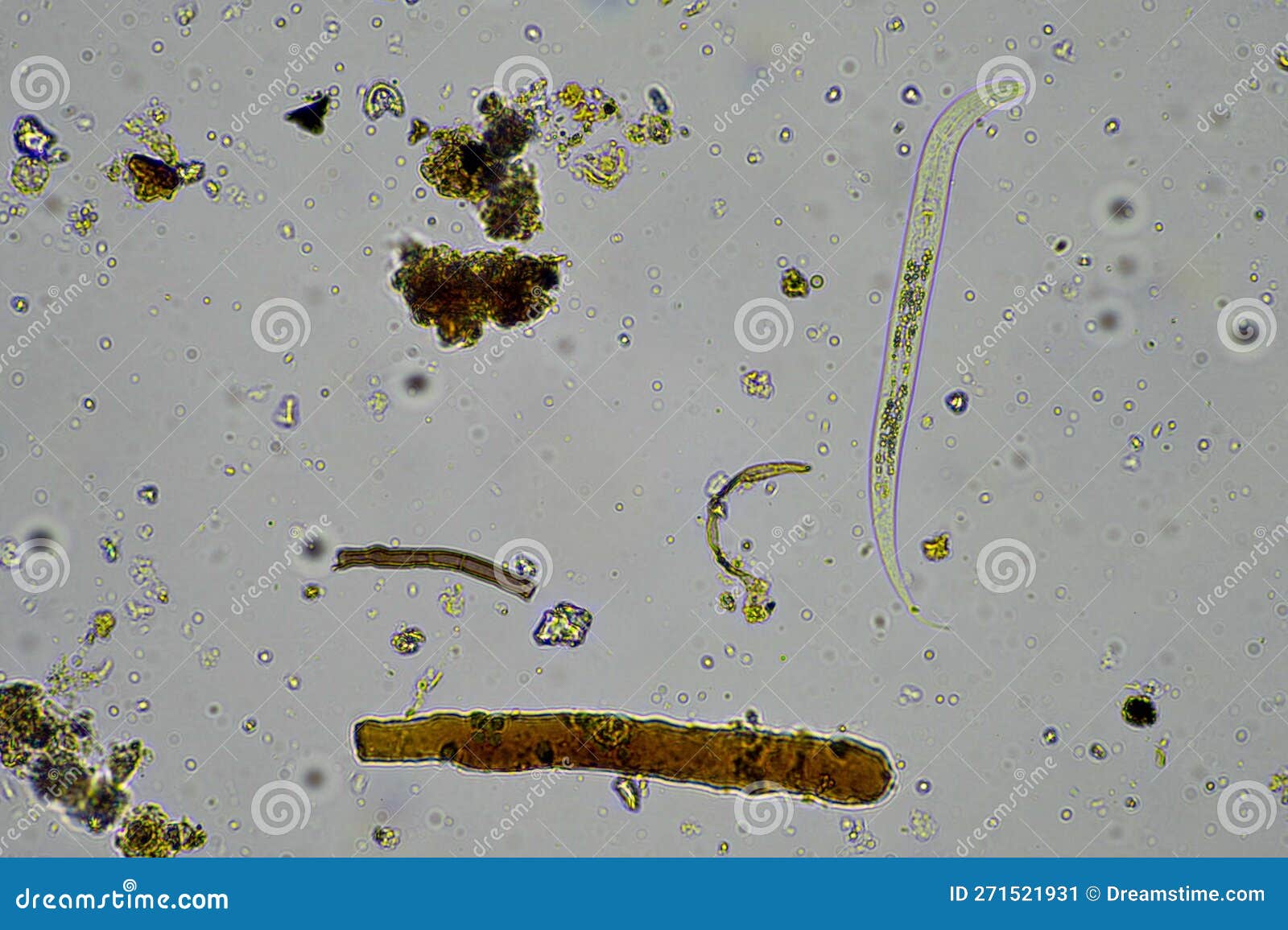 microorganisms in pond water under microscope