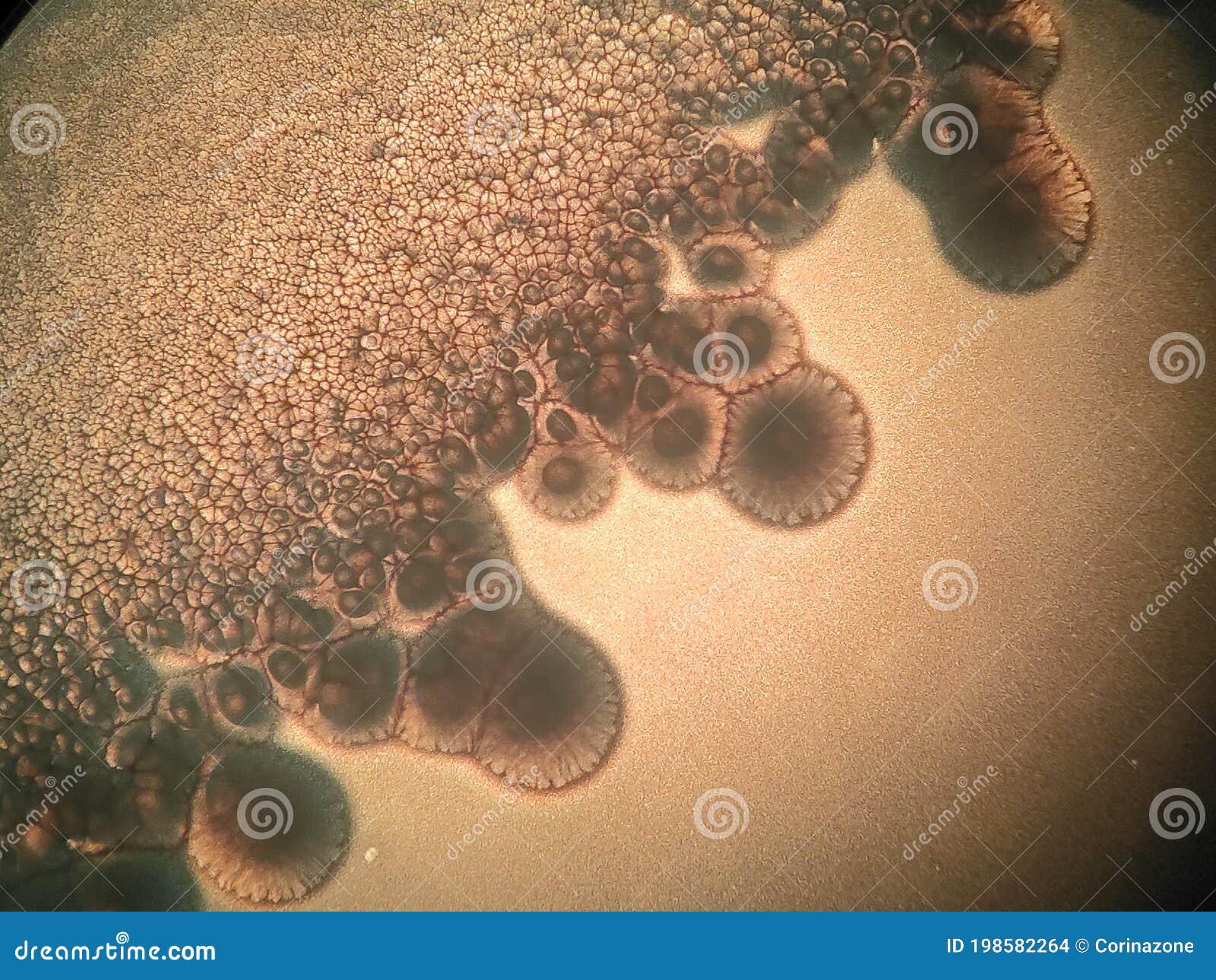 Microscope View of a Bacterial Colonies and Candida Albicans Stock