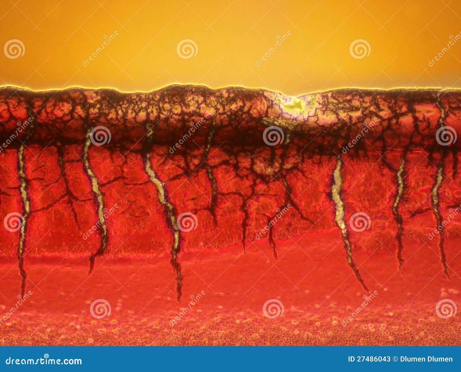 microscopic picture of a blood clot