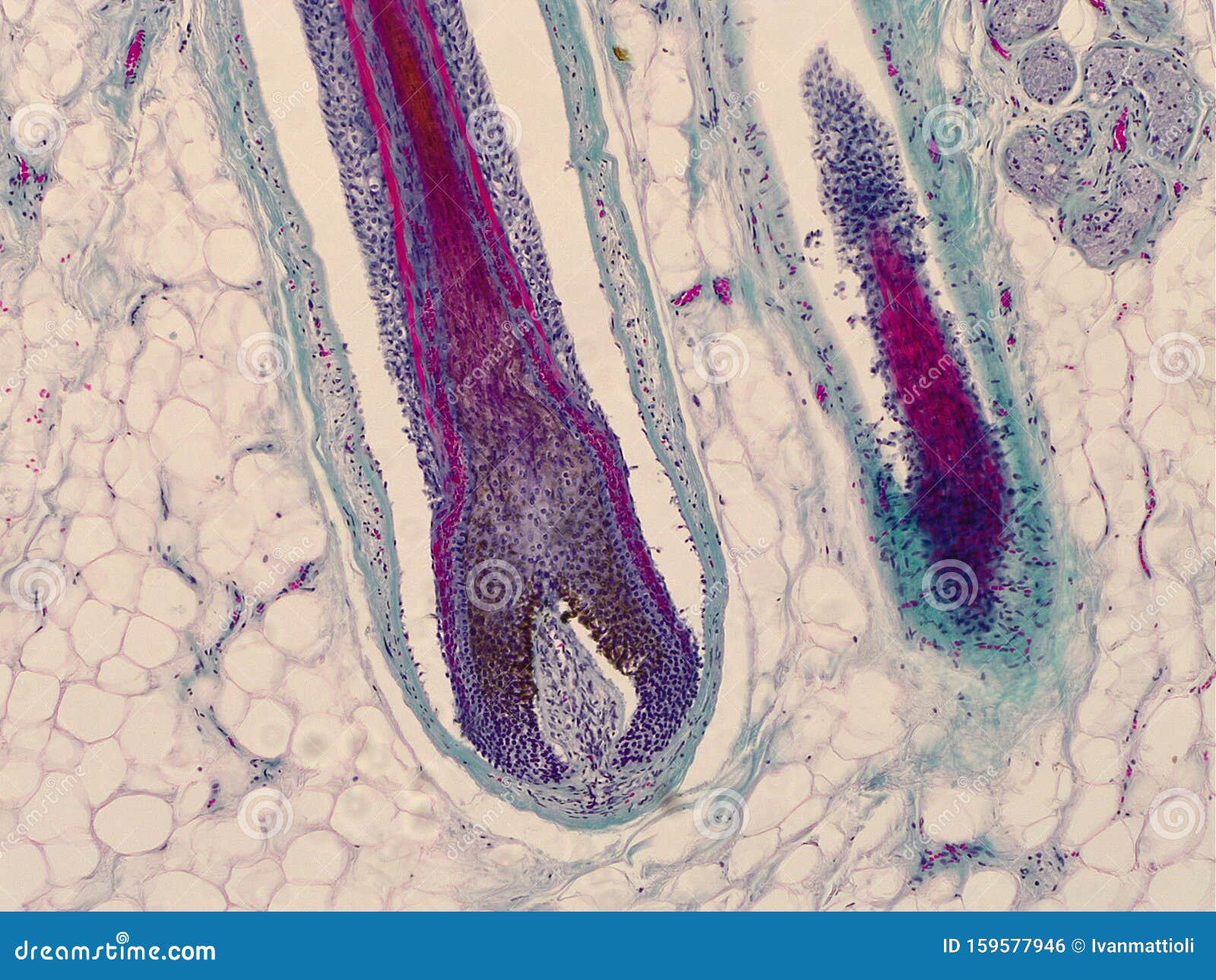 human hair root microscope