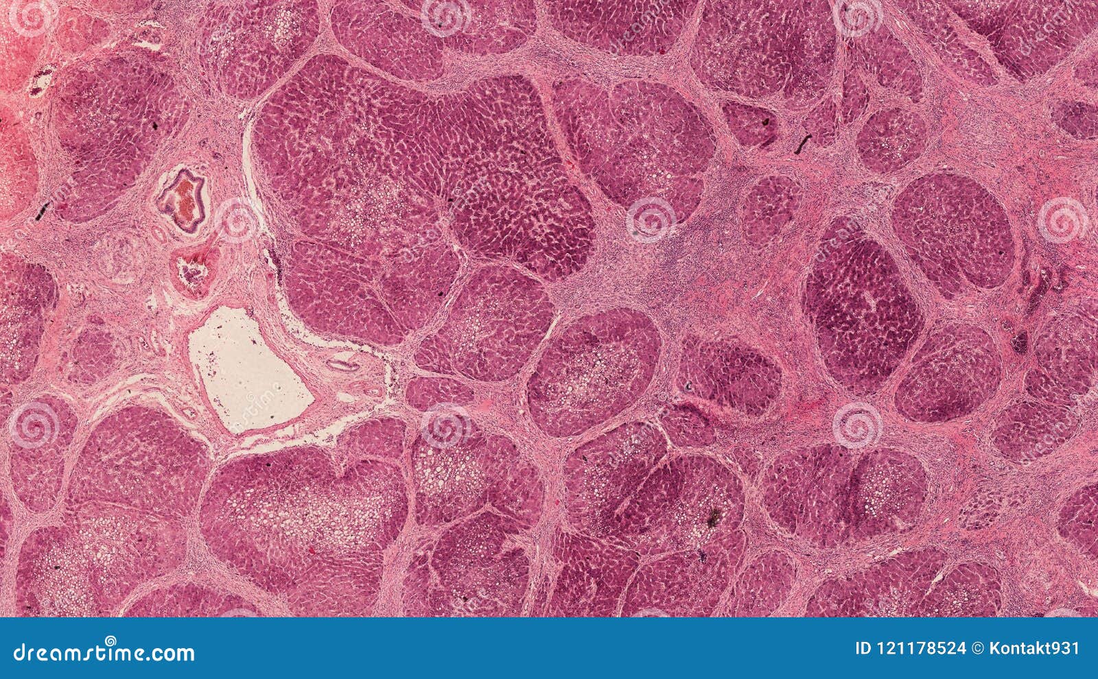 Cross Section Cut Under the Microscope – Microscopic View of Animal Cells for Education Stock Photo - Image of microscopy, microscope: 121178524 Cross Section Cut Under the Microscope – Microscopic View of Animal Cells for Education Stock Photo - Image of microscopy, microscope: 121178524