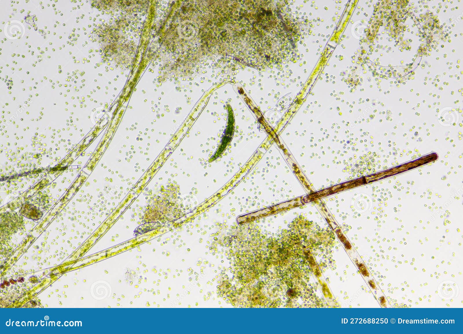 Microscopic View of Detritus with Various Species of Freshwater Algae