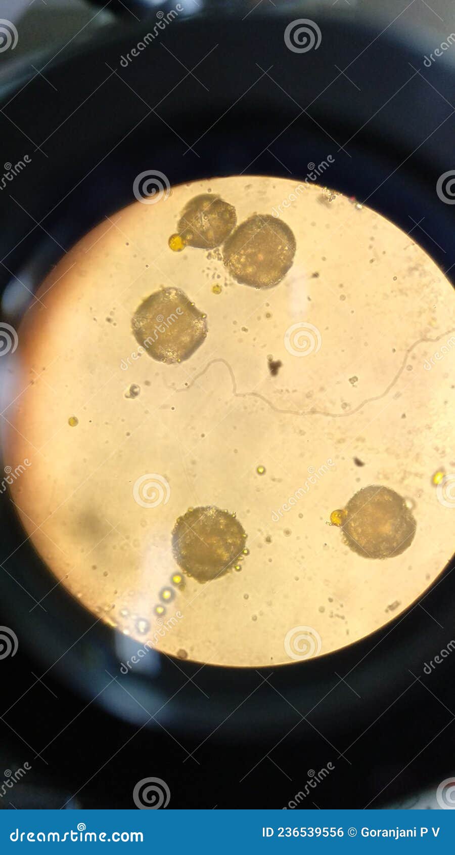microscopic view of germinating pollen grains