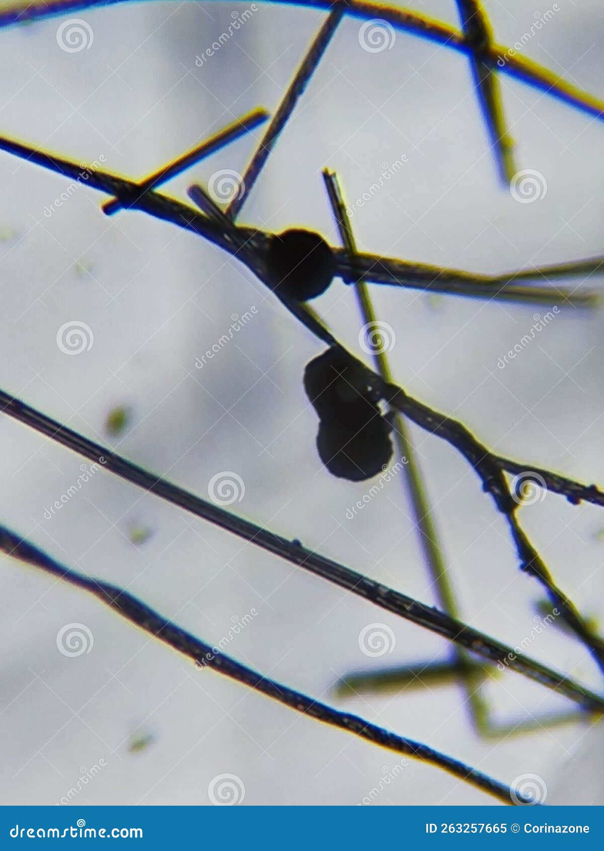 aspergillus genus mold under the microscope