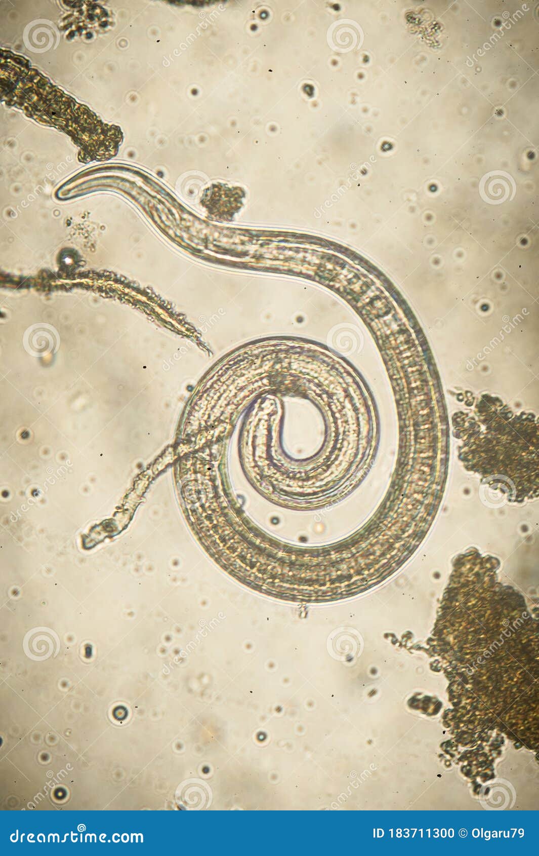 Microscópio De Nematoda Parasita Trichinella Spiralis Foto De Stock