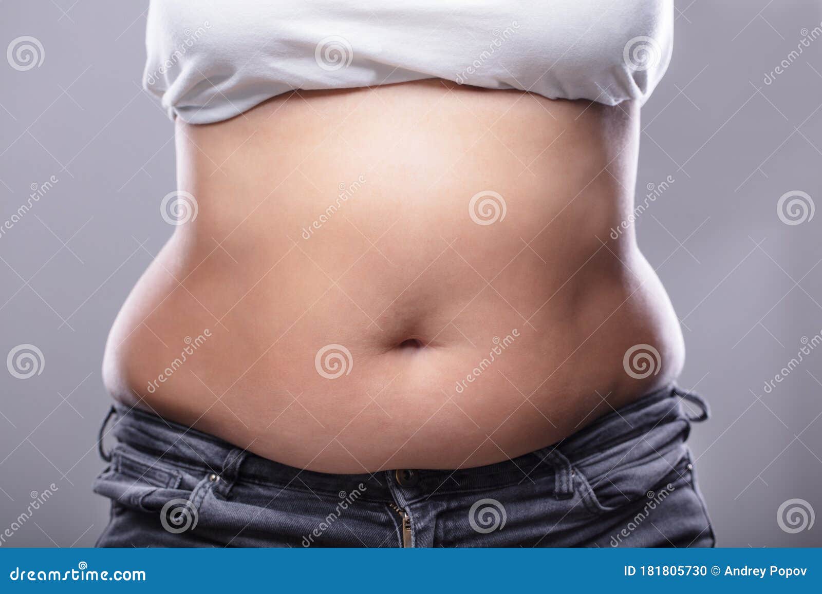 Woman With Excessive Belly Fat Stock Photo Image Of