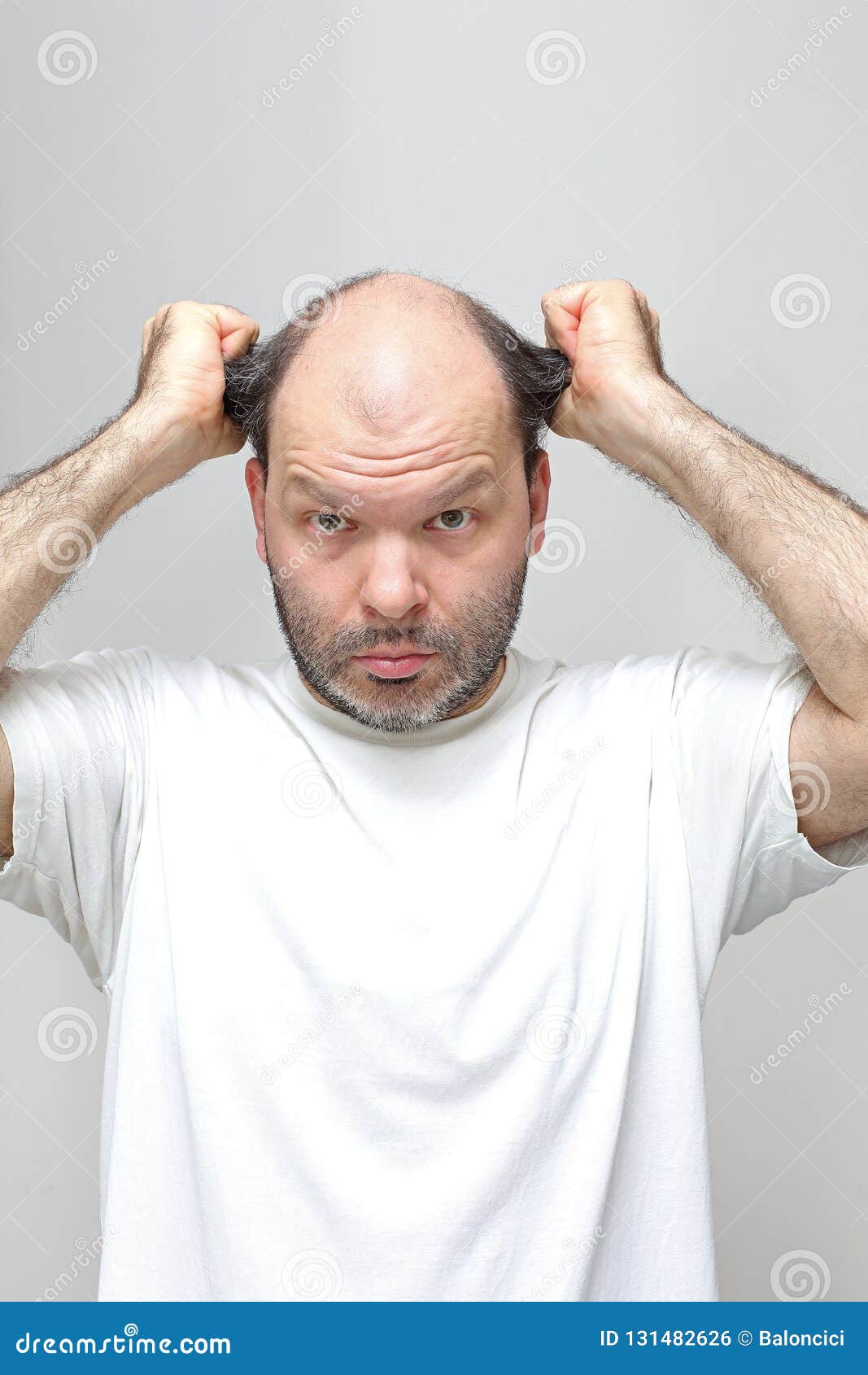 Man Pulling Hair Baldness stock photo. Image of beard 131482626