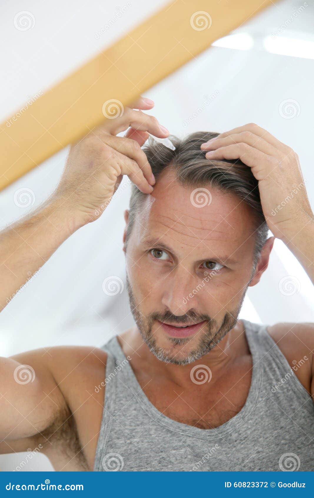 Middleaged Man Applying Hair Loss Treatment Stock Photo Image of