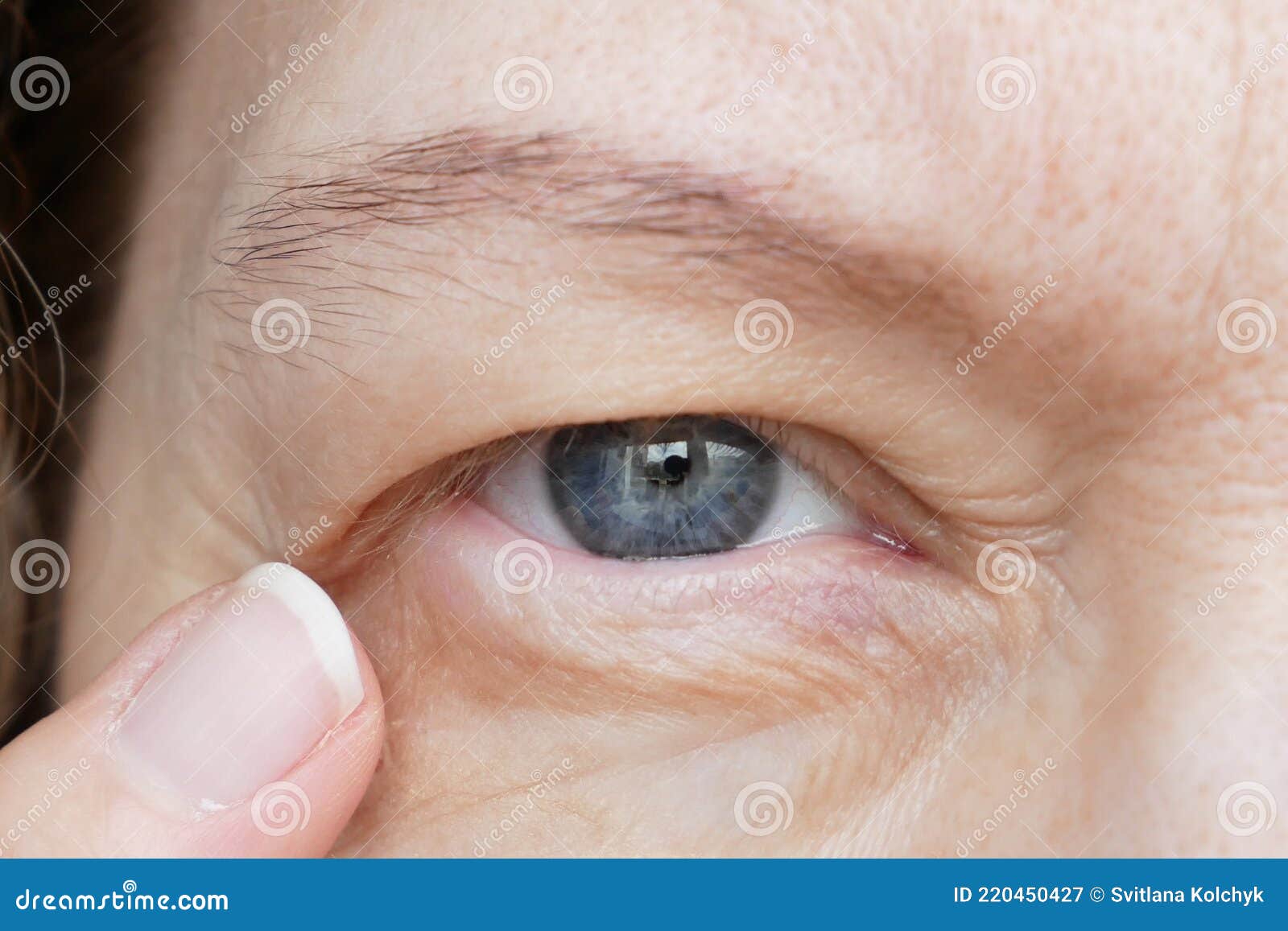 middle-aged woman does corrective eye makeup to correct the drooping eyelid. ptosis is a drooping of the upper eyelid, lazy eye.