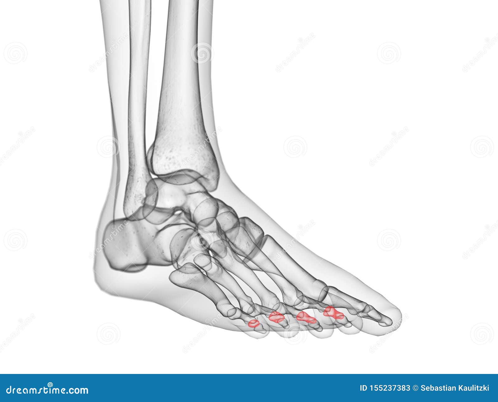 the middle phalanx bones