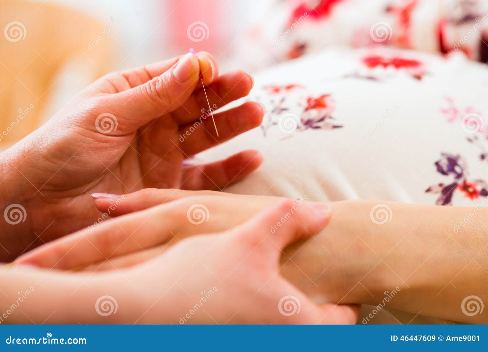 midwife giving pregnancy acupuncture