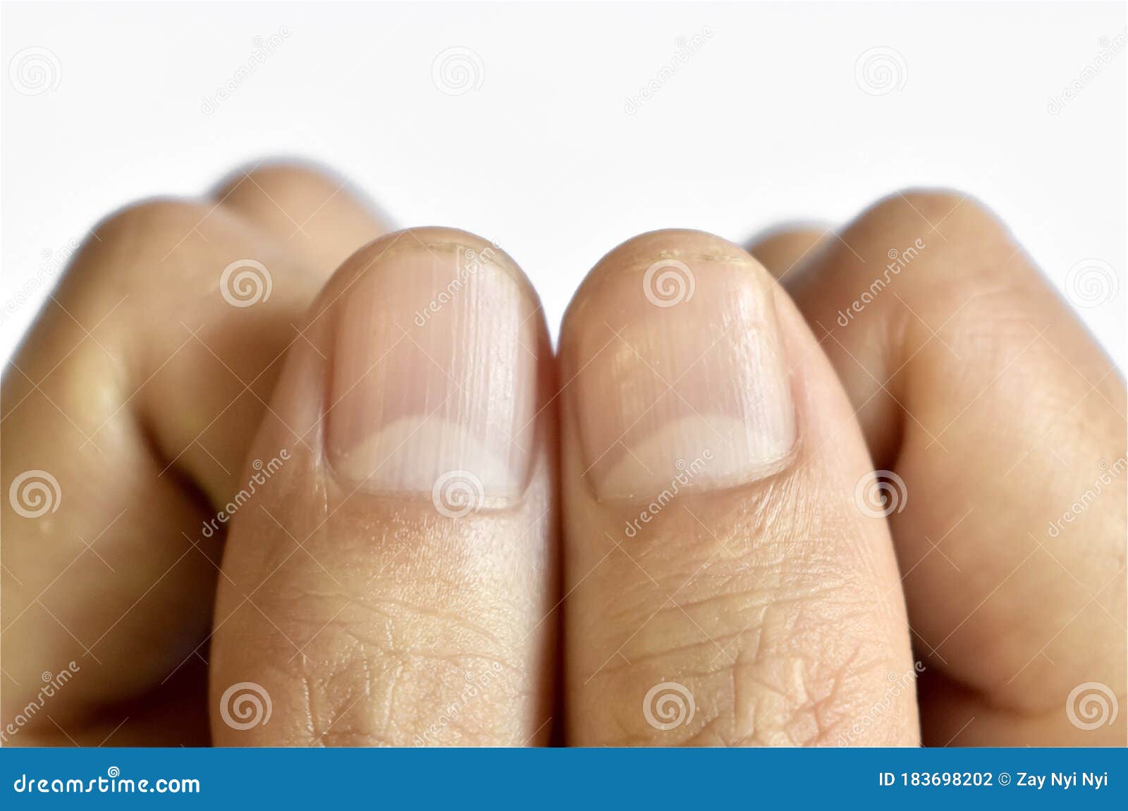 Vertical lines on the nails (3)#verticalline #nails #fingers #tiktok #... |  TikTok