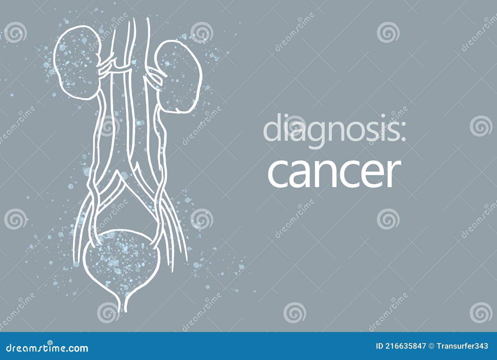 cancer kidney disease or renal cell carcinomas. malignant kidney tumors.