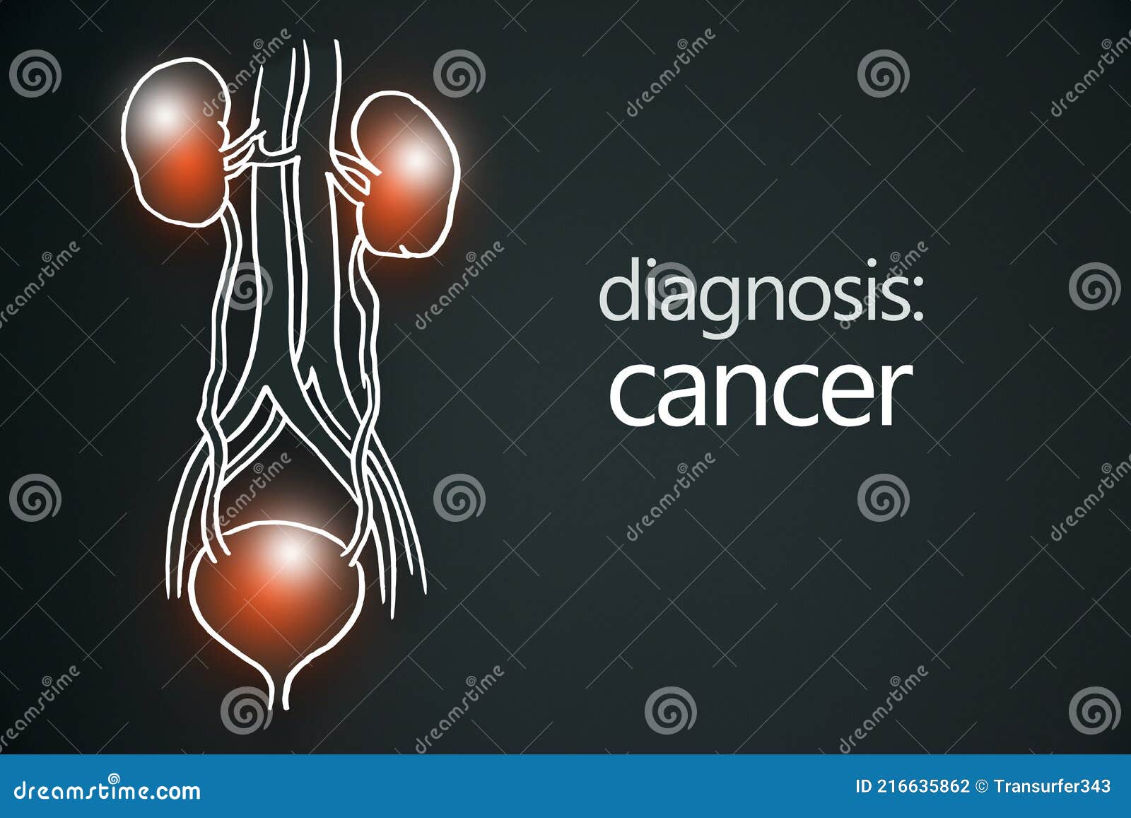 cancer kidney disease or renal cell carcinomas. malignant kidney tumors.