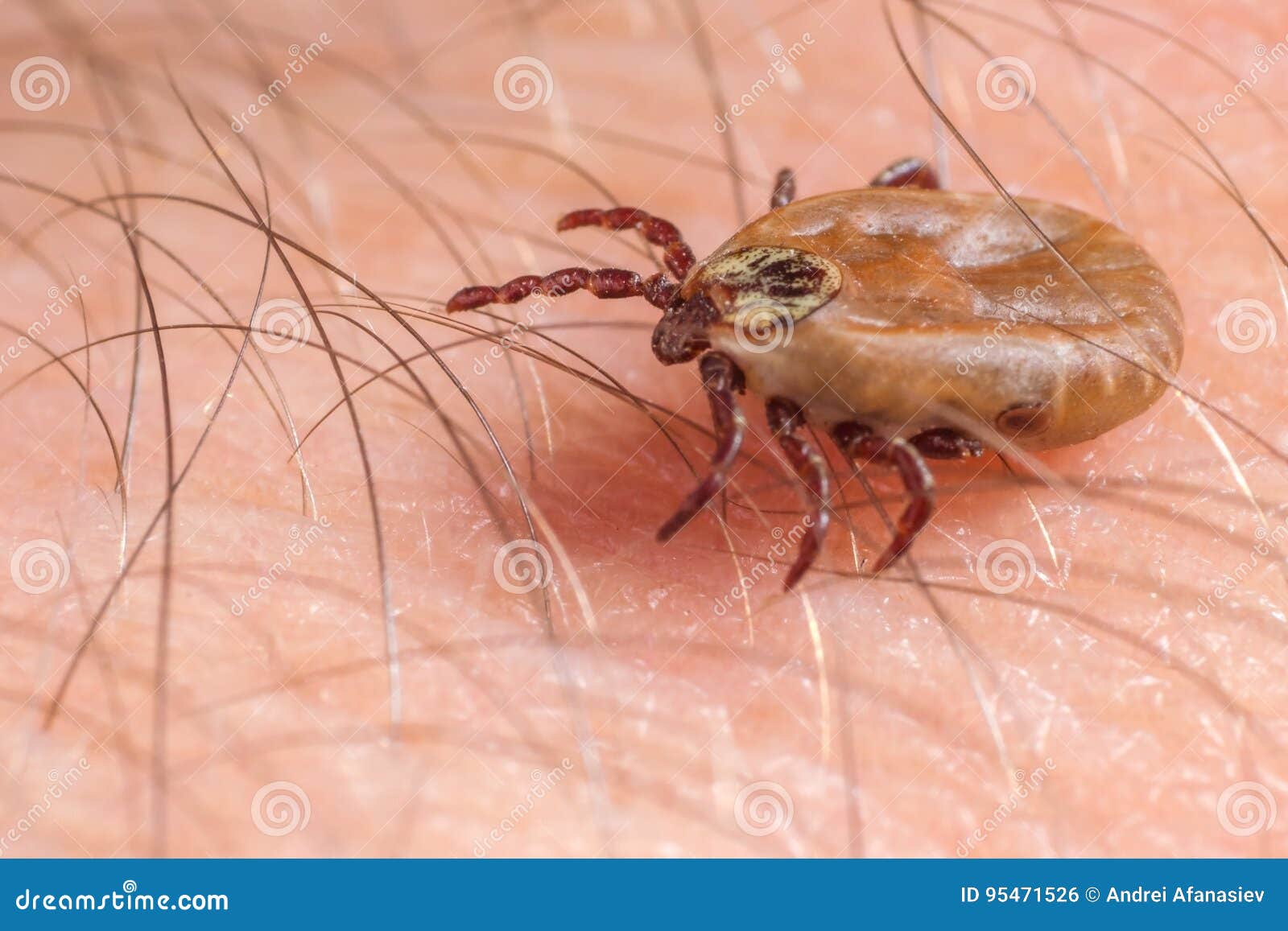 Mite crawls on human skin stock photo. Image of animal 95471526