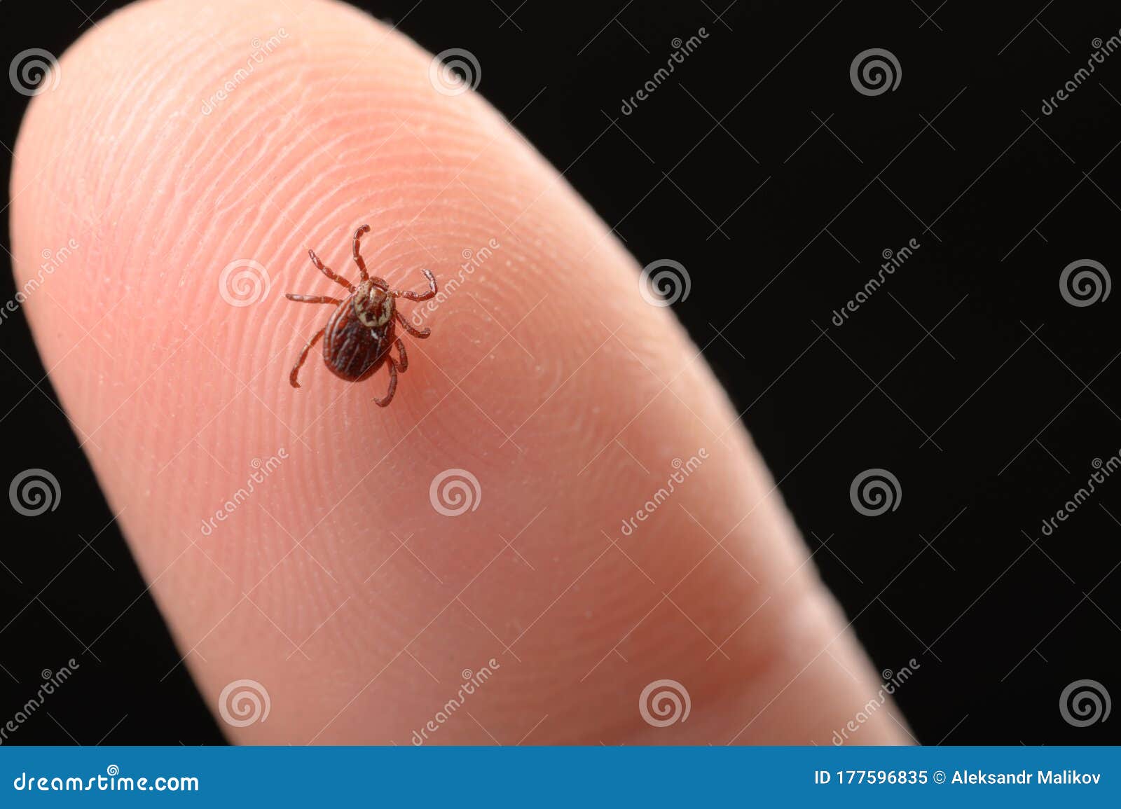 1 Mite Finger Photos Free Royalty Free Stock Photos From Dreamstime 1 Mite Finger Photos Free Royalty Free Stock Photos From Dreamstime