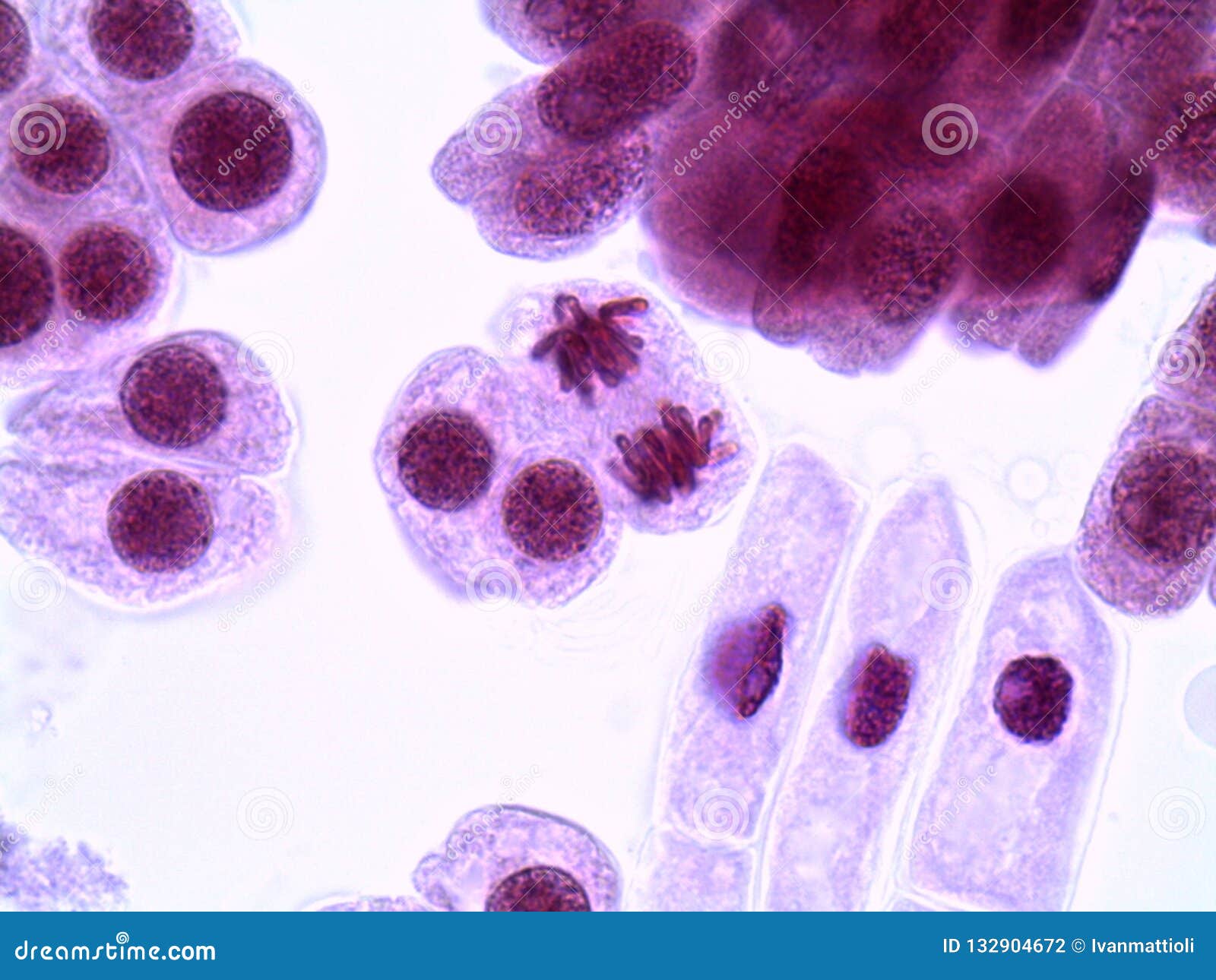 mitotic cells in onion root tips under the microscope