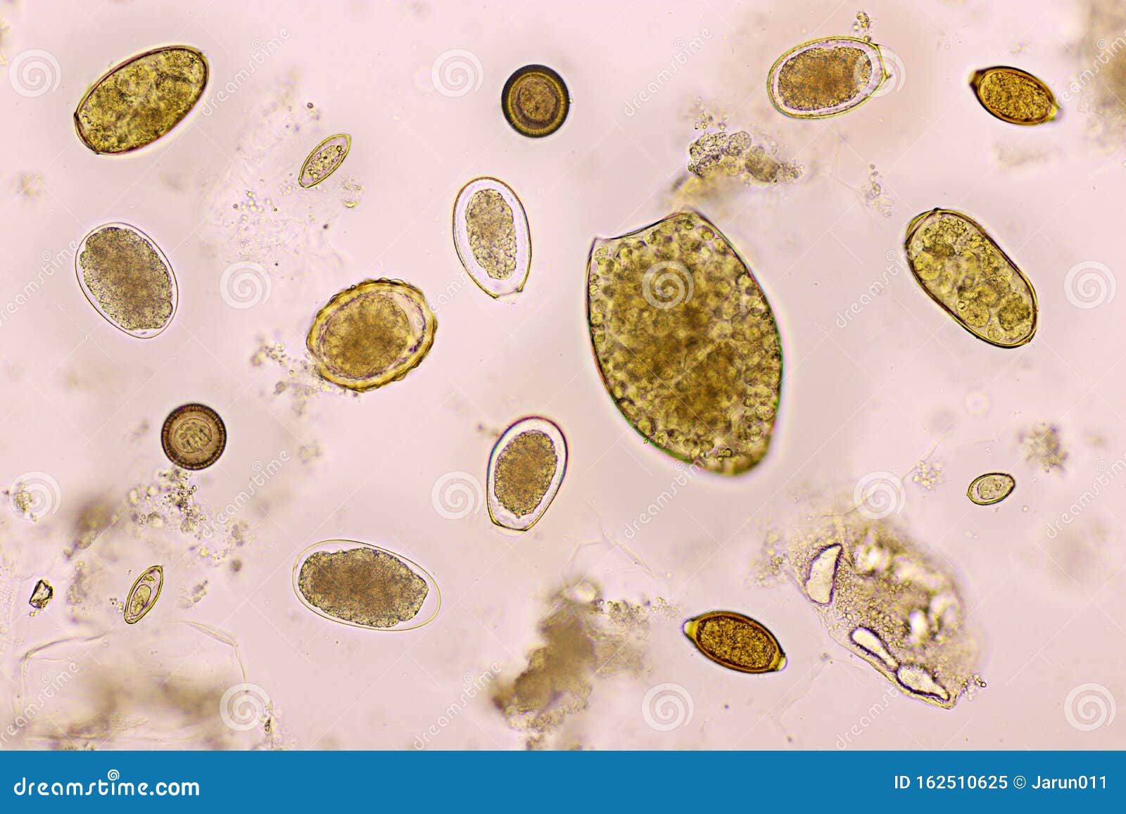 helminths vs parasitic worm colpocid pentru condiloame