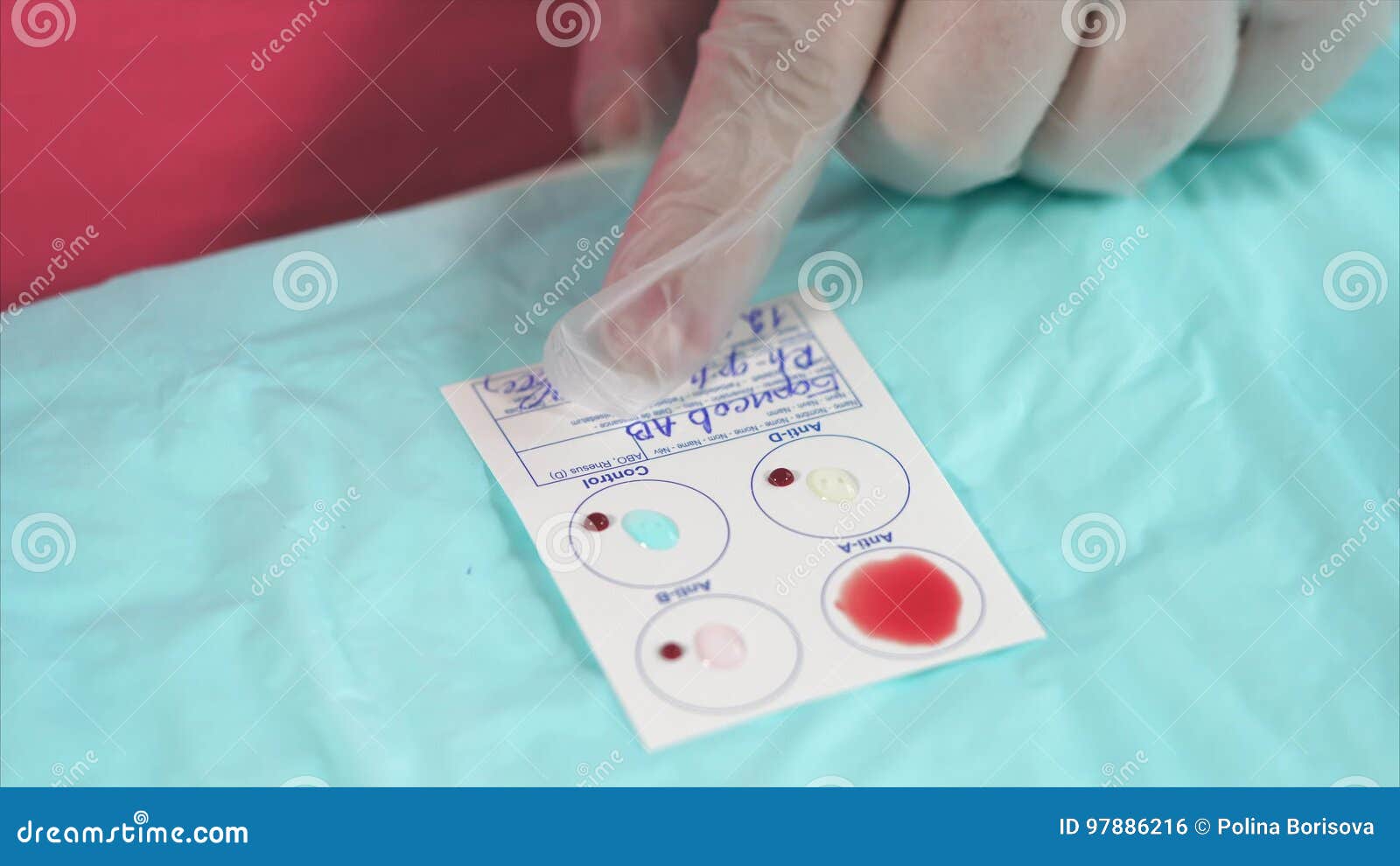 Mixing of Blood and Dissolution of Antibodies on Testing Panel Stock