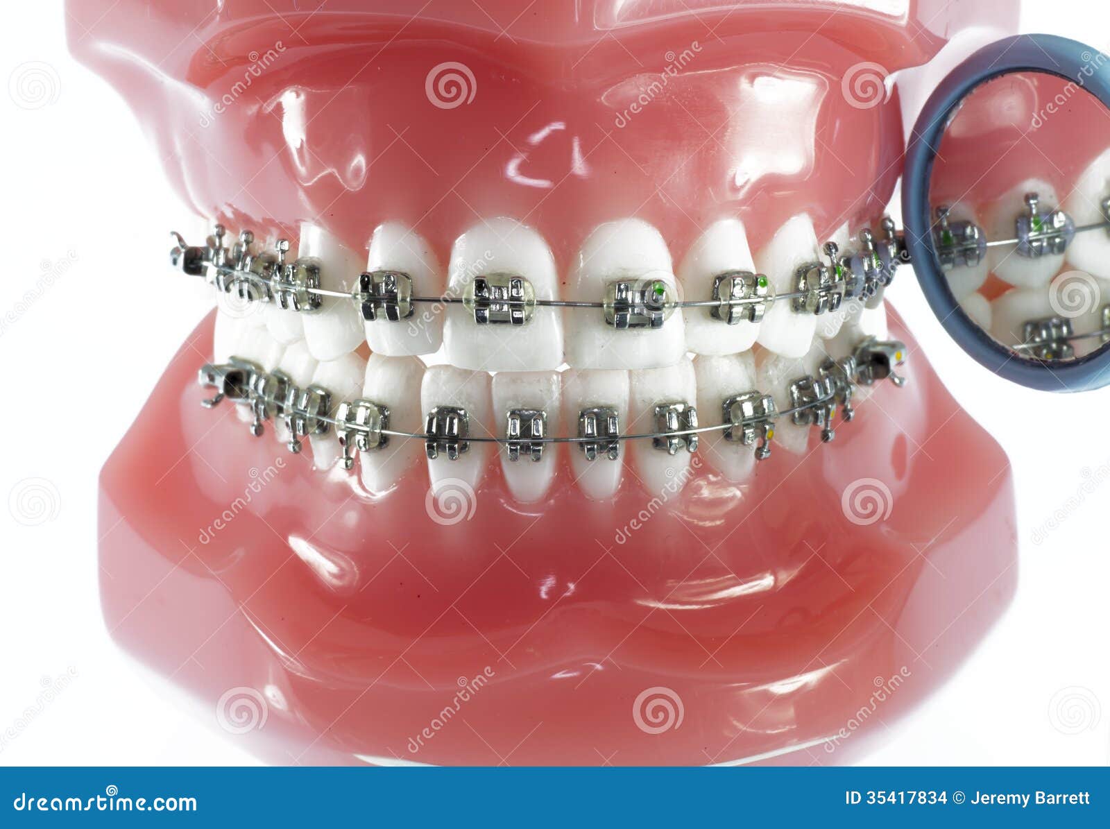 Model of Teeth with Braces and Dental Mirror Stock Photo Image of