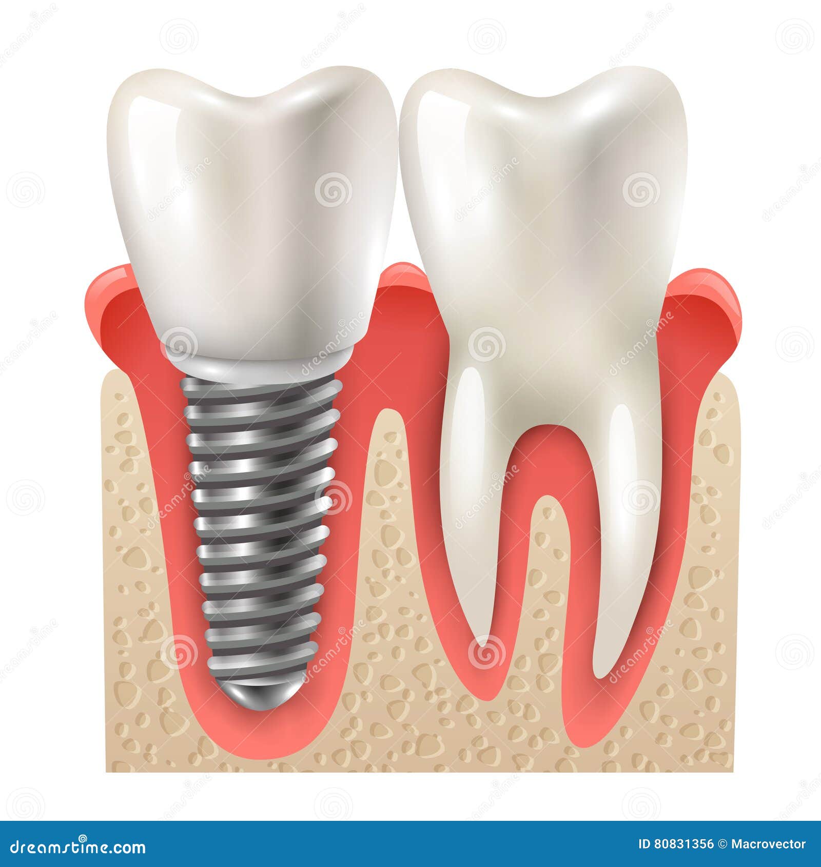 Anatomia da Maxila – Odonto Up