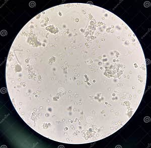 Moderate Bacteria And White Blood Cells In Urine Stock Image Image Of Health Clinical 256546305 Moderate Bacteria And White Blood Cells In Urine Stock Image Image Of Health Clinical 256546305