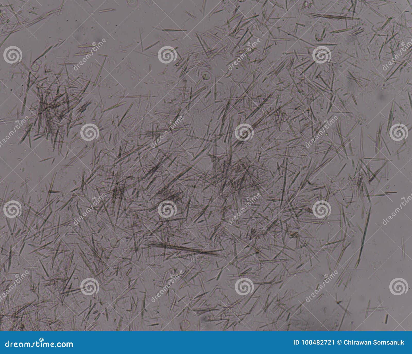 Treatment and management of pseudogout: insights for the clinician - Paul  MacMullan, Geraldine McCarthy, 2012, image size:1600x1376