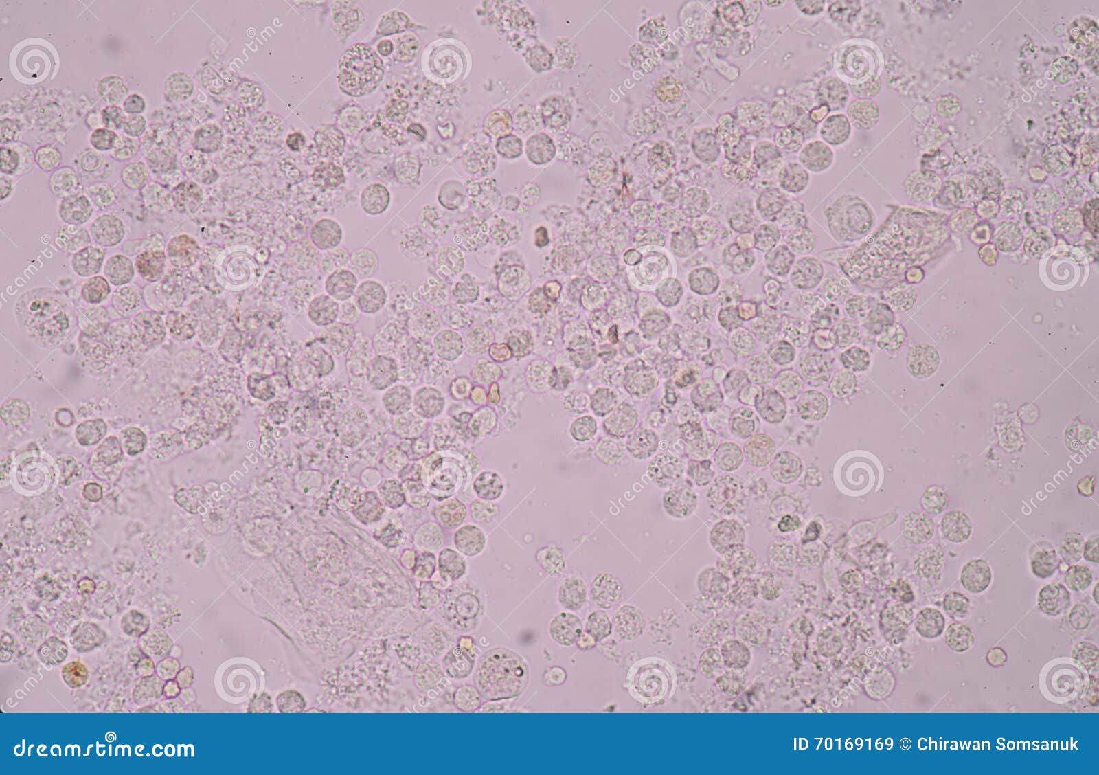 moderate-white-blood-cells-red-blood-cells-bacteria-cells-in-uri-stock-image-image-of
