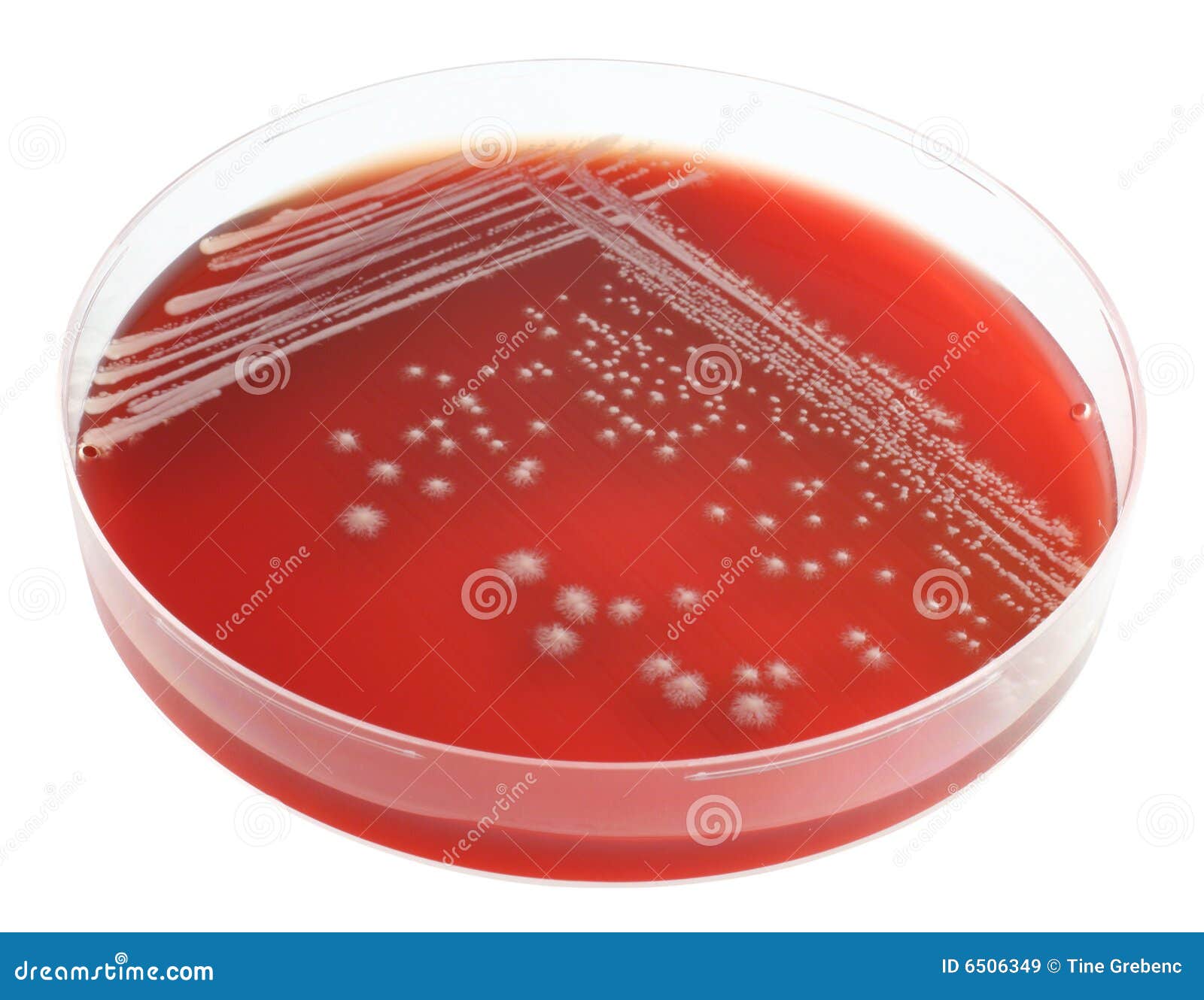Mold stock image. Image of aspergillus, antibiotic, hospital 6506349