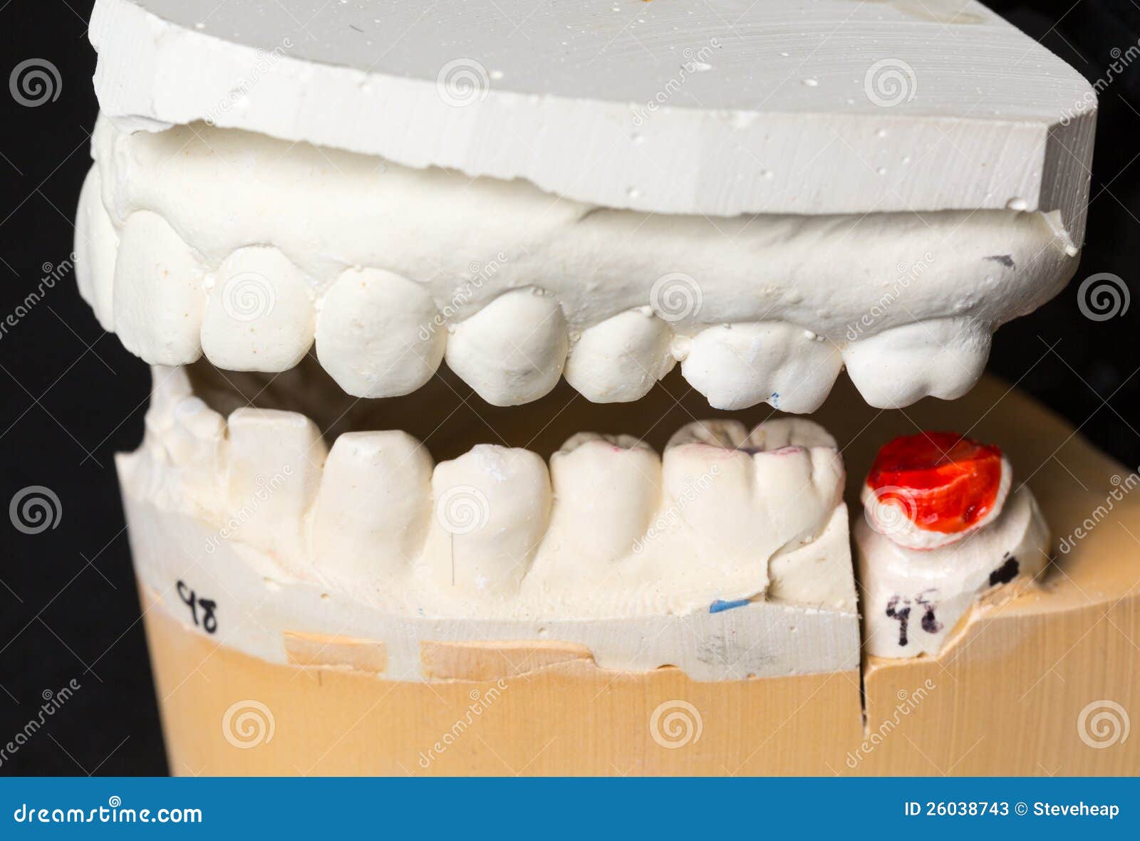 Vintage Dental Teeth Mold Plaster Casting