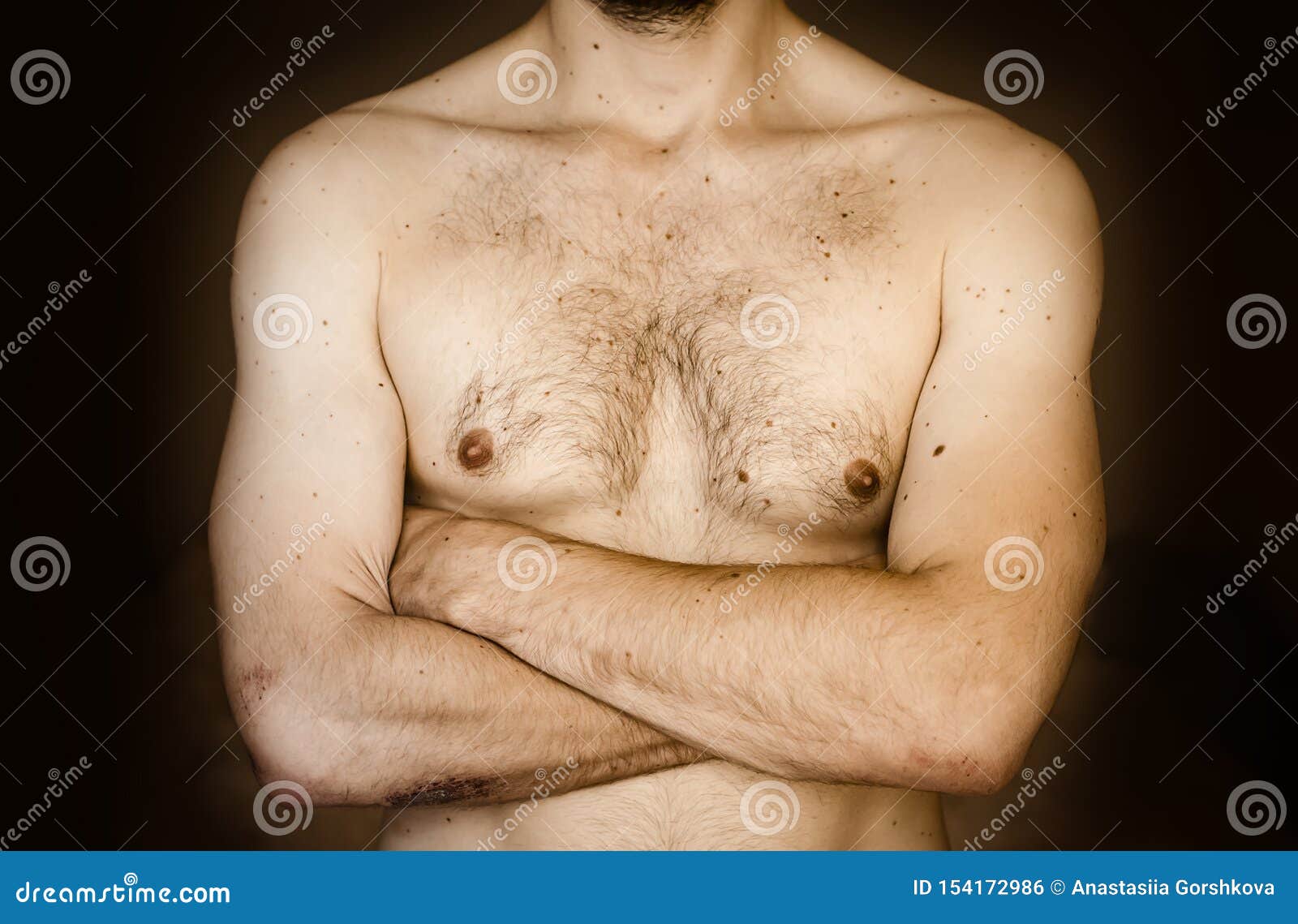 пятнышко на груди у мужчин (120) фото