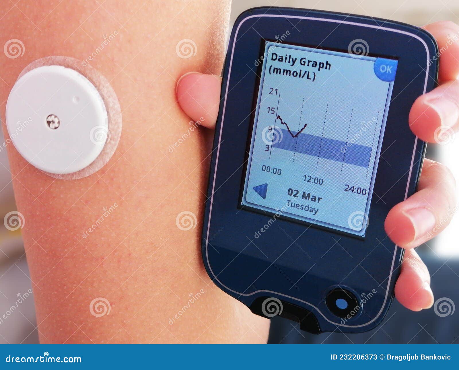 moment of  reading a glucose levels using device for continuous glucose monitoring in blood Ã¢â¬â cgm.