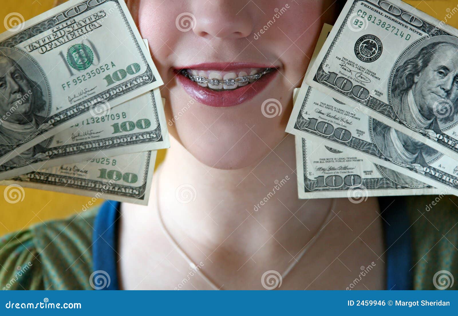 Money for braces stock photo. Image of bracket, expensive 2459946