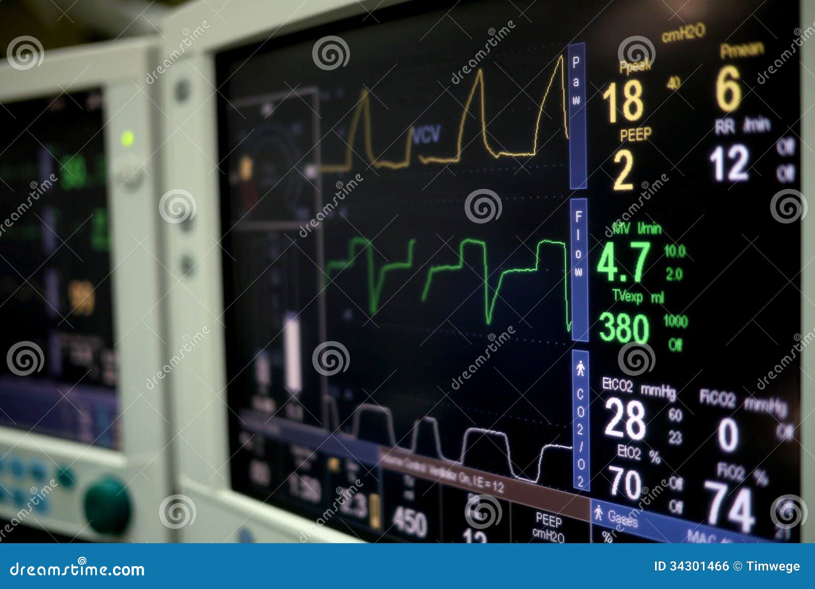 Monitor De Corazón En Teatro Del Hospital Foto de archivo Imagen de