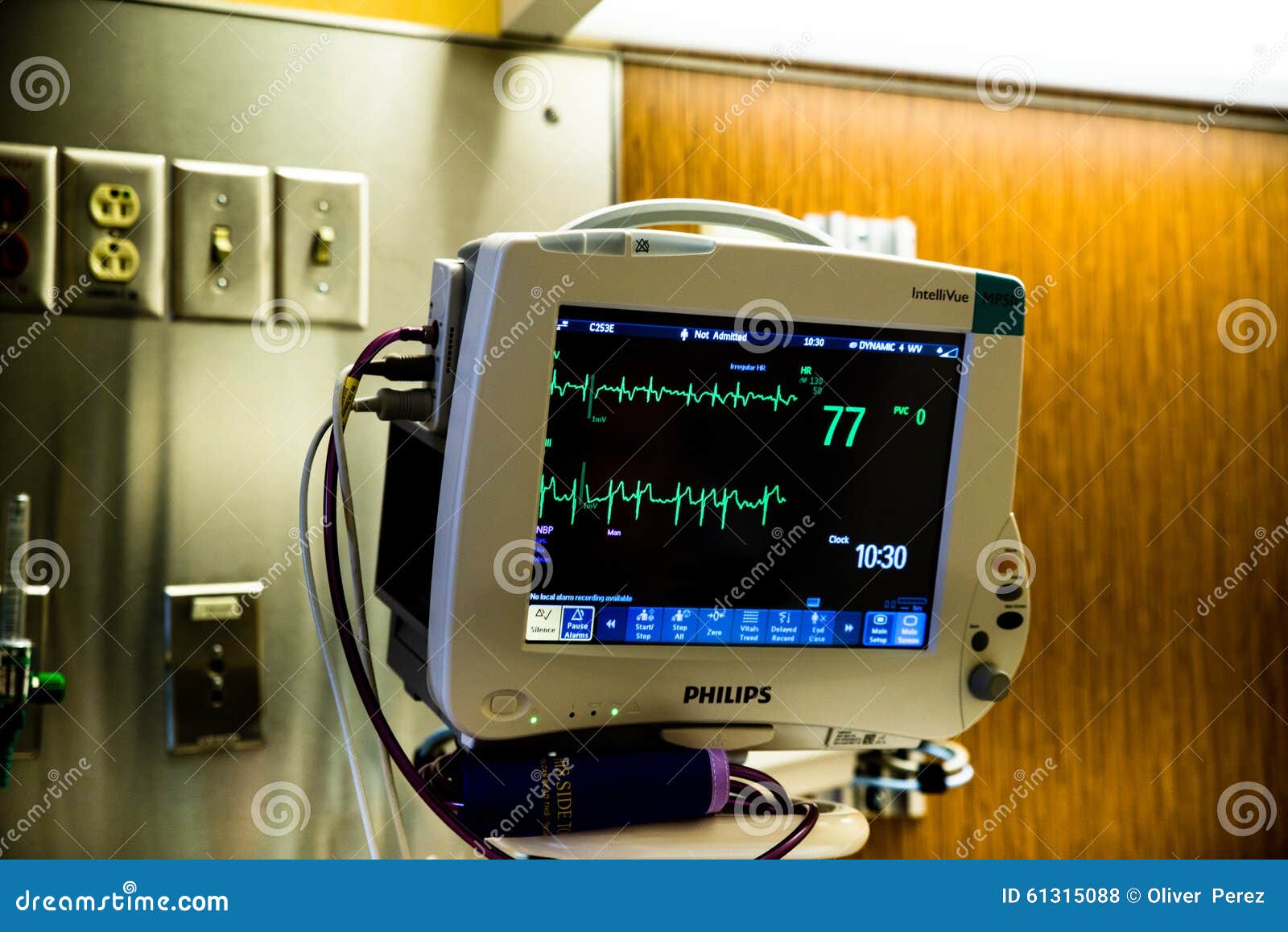 Monitor De Corazón Que Muestra Latido Del Corazón Irregular Foto de