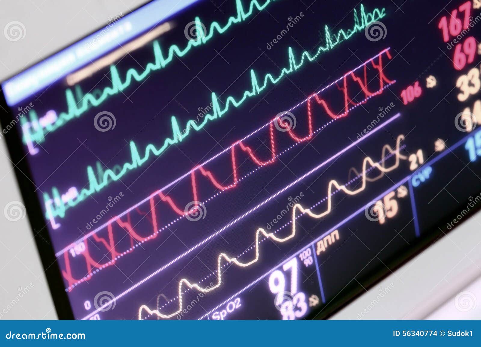 Monitoring of the Patient in the ICU Stock Photo Image of equipment