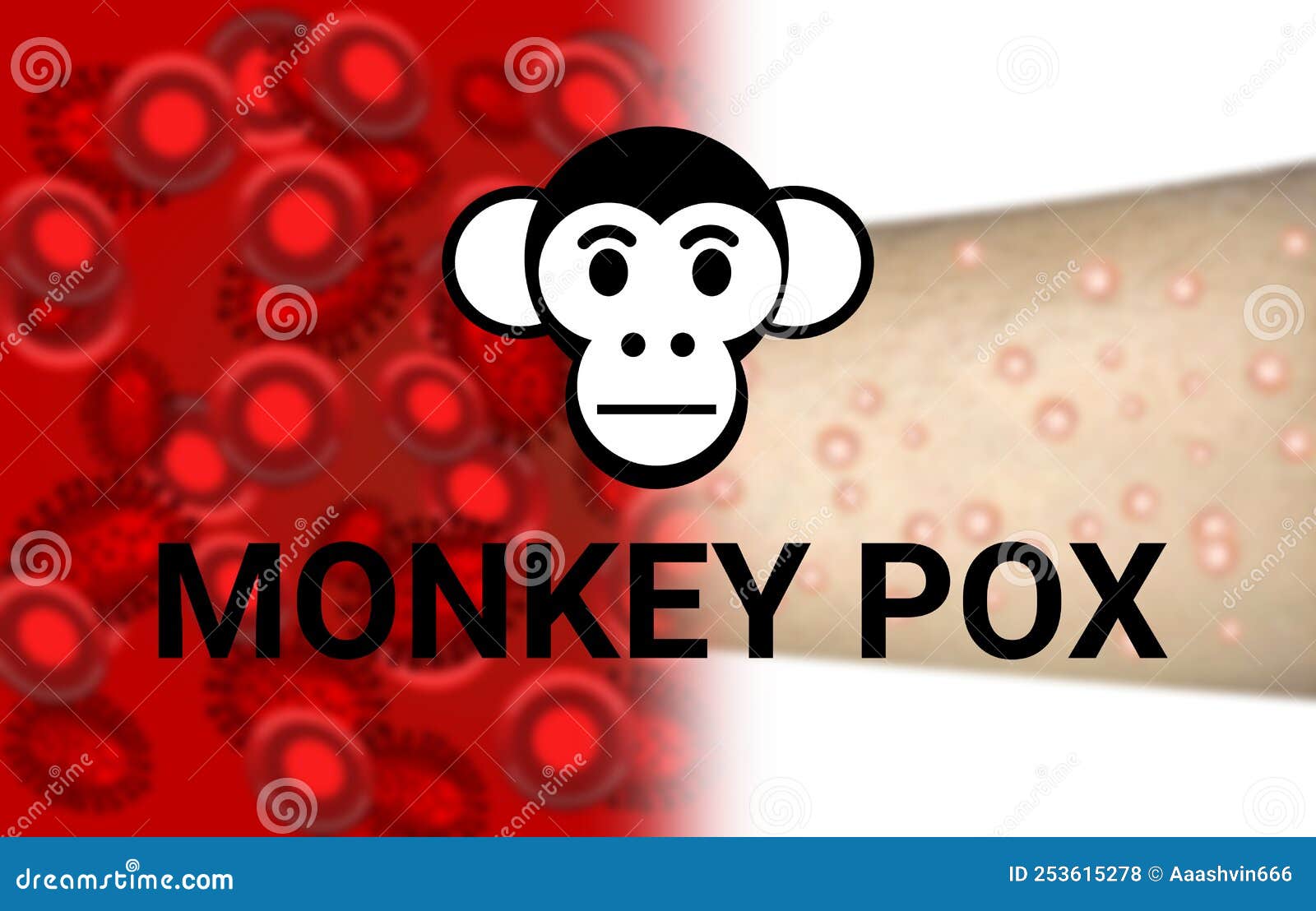 monkey pox virus pendamic background with blur infected hand and virus in blood