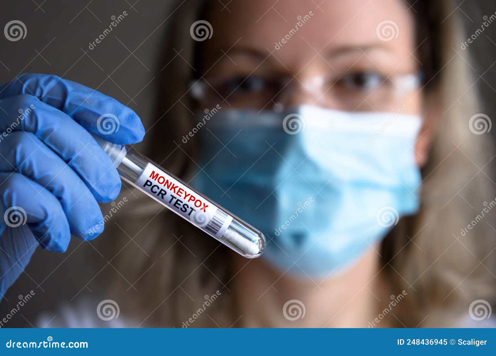 monkeypox pcr test tube in doctors hand