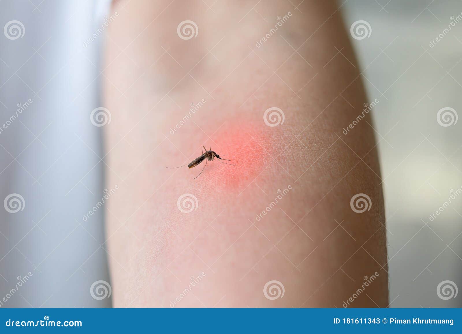 Mosquito Bite On Adult Arm With Skin Rash And Allergy With Red Spot