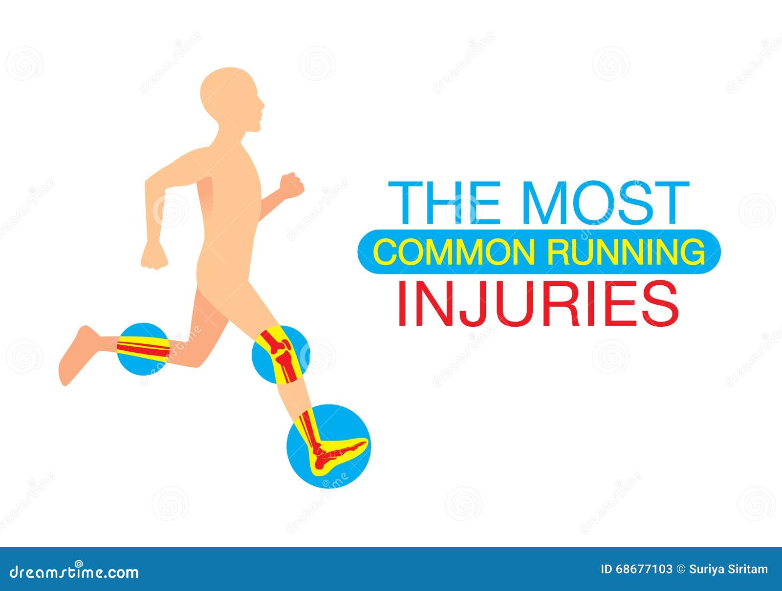 the most common running injuries