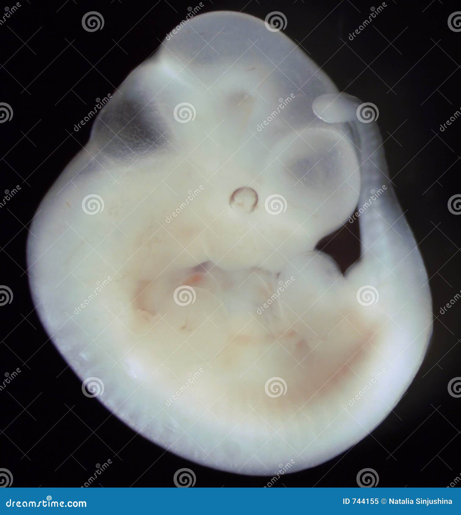 Mouse Embryo, Day 11 of Development Stock Image - Image of biology, medical: 744155 Mouse Embryo, Day 11 of Development Stock Image - Image of biology, medical: 744155